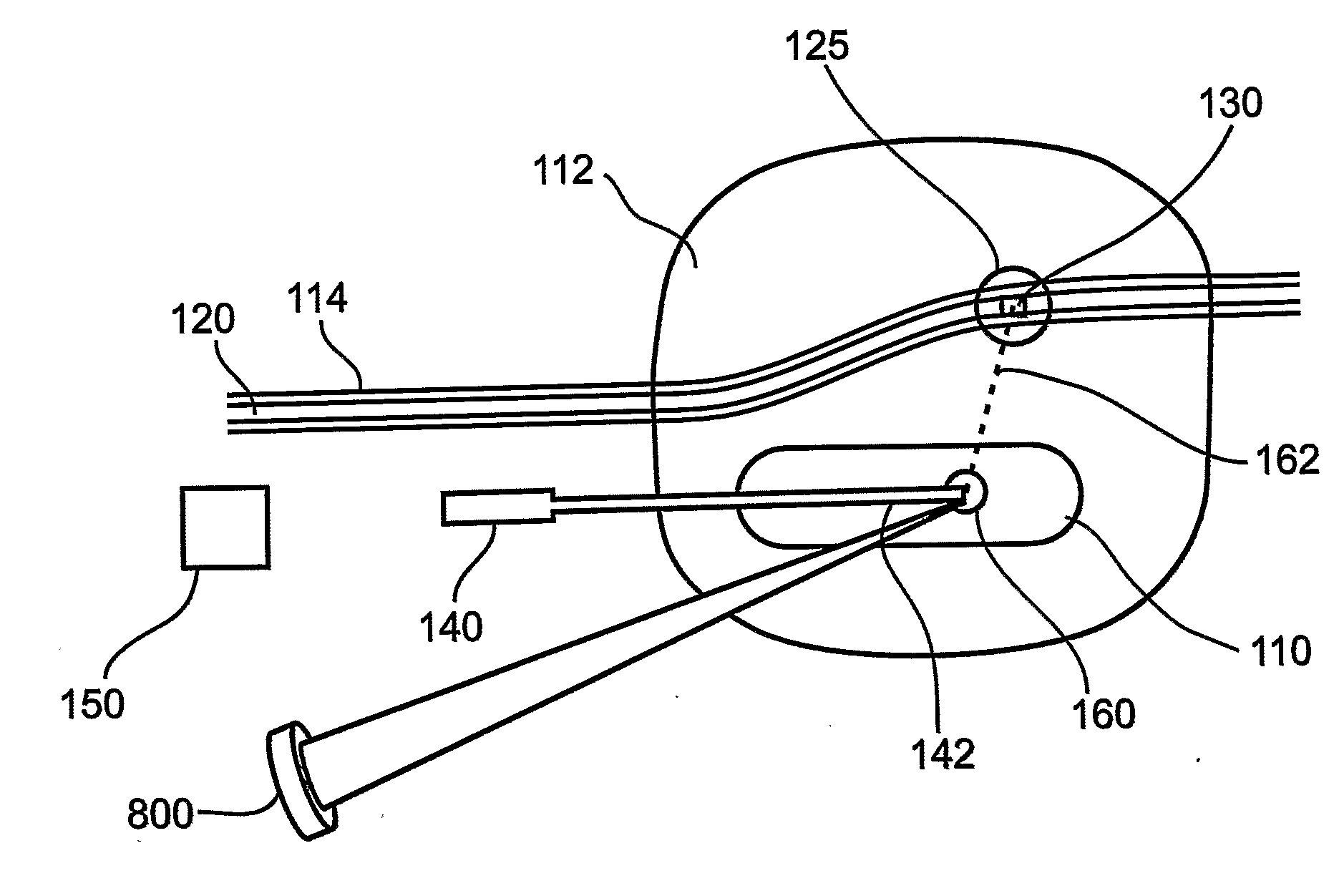 Method and Apparatus for Positioning a Medical Instrument