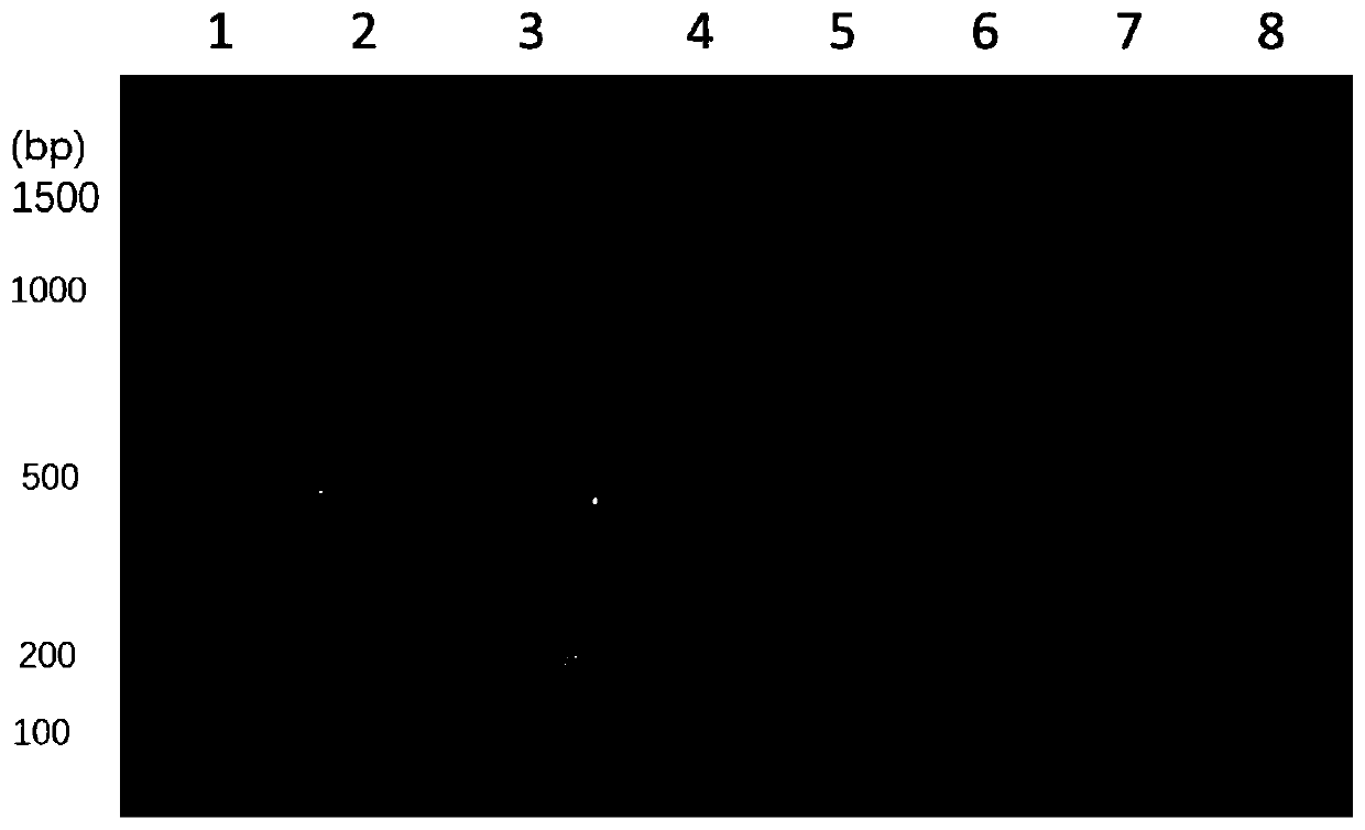 Method for detecting escherichia coli pathogenic bacteria from clinical blood