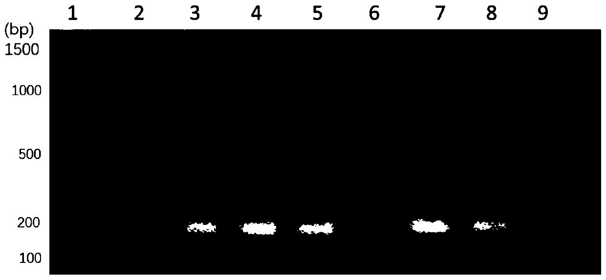 Method for detecting escherichia coli pathogenic bacteria from clinical blood