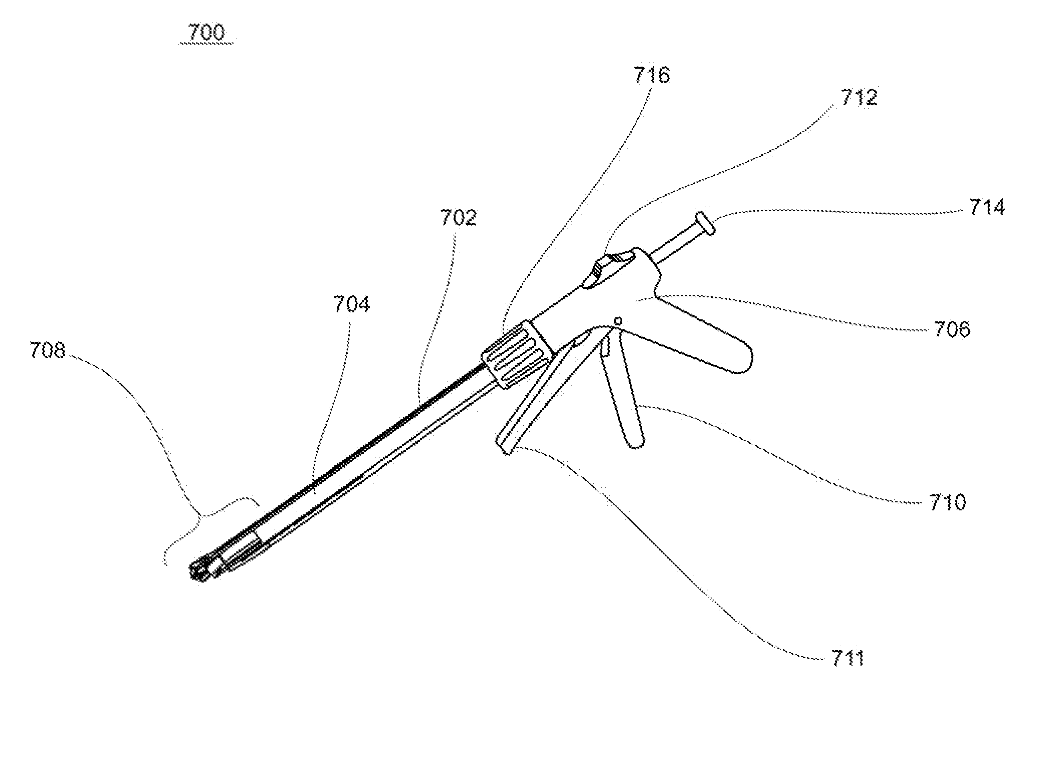 Devices for  reconfiguring a portion of the gastrointestinal tract