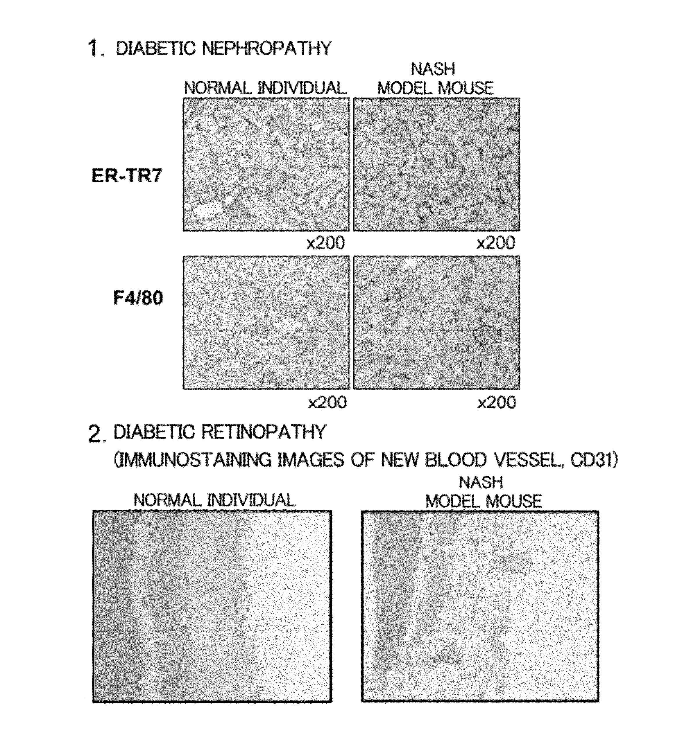 Steatohepatitis-liver cancer model animal