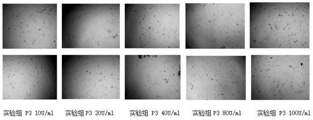 Composition for treating alopecia and preparation method thereof