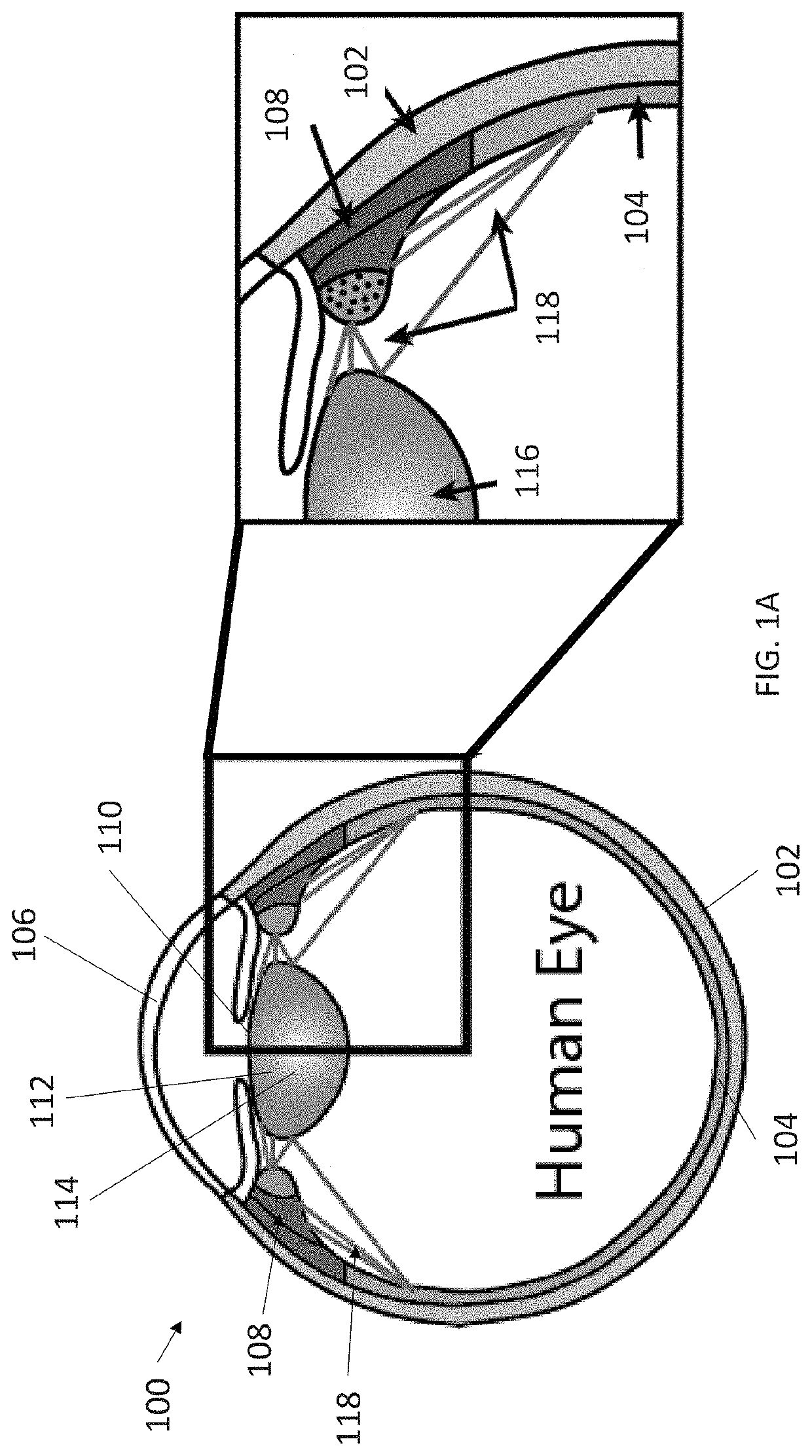3-dimensional model creation using whole eye finite element modeling of human ocular structures