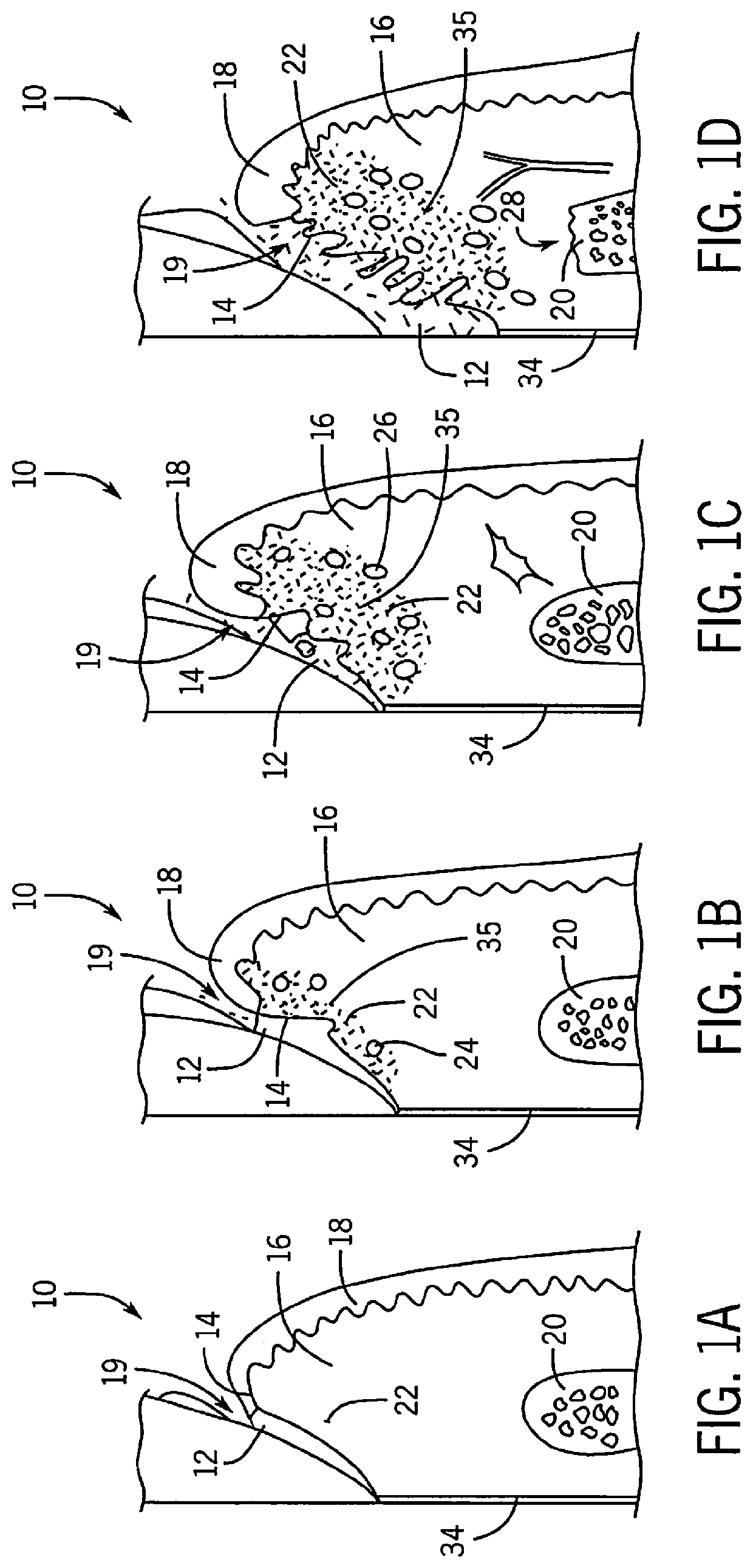 Host modulating and tissue regenerative hydrogel compositions and methods of their delivery to periodontal and peri-implant tissues