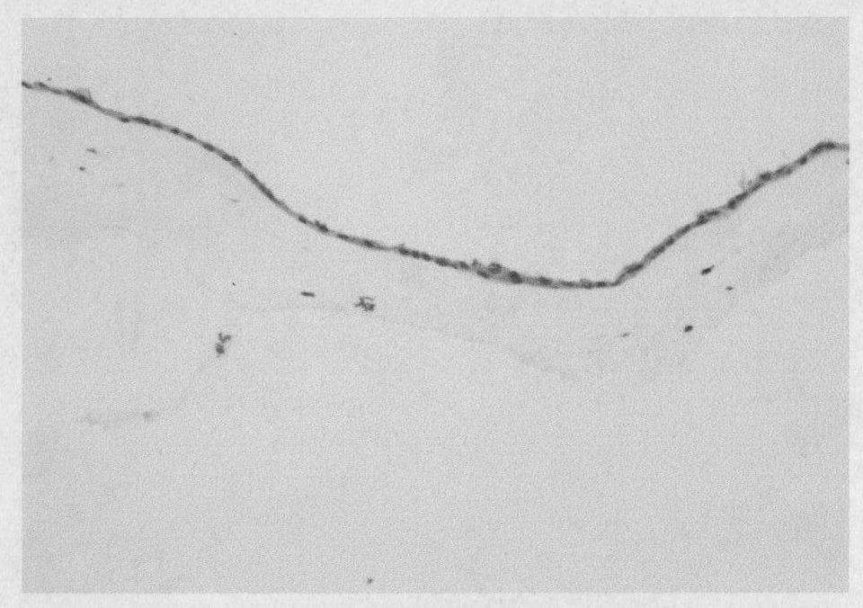 Amniotic membrane long-term preserving fluid and preparation method thereof