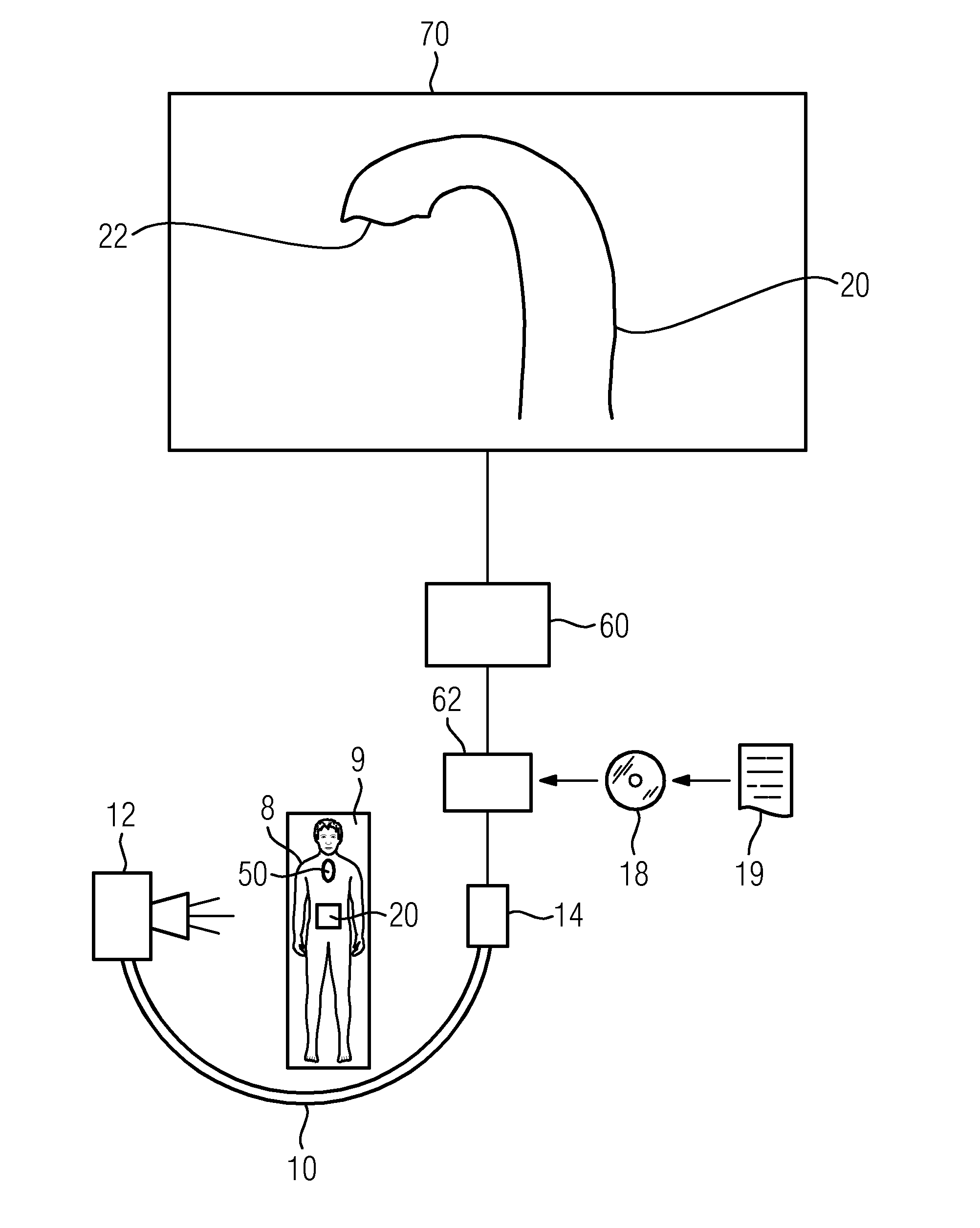 Method and x-ray device for temporal up-to-date representation of a moving section of a body, computer program product and data carrier