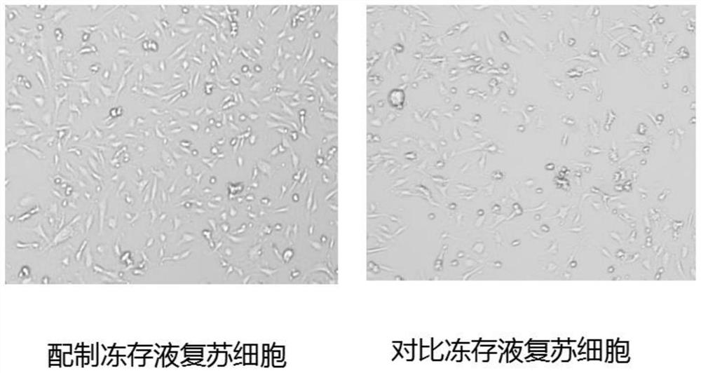 Serum-free cell cryopreservation solution as well as preparation method and use method thereof