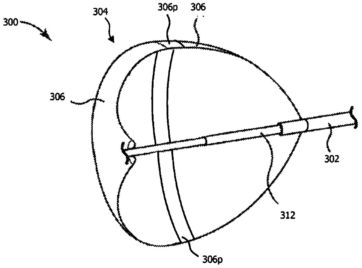 Calcium electroporation delivery apparatus