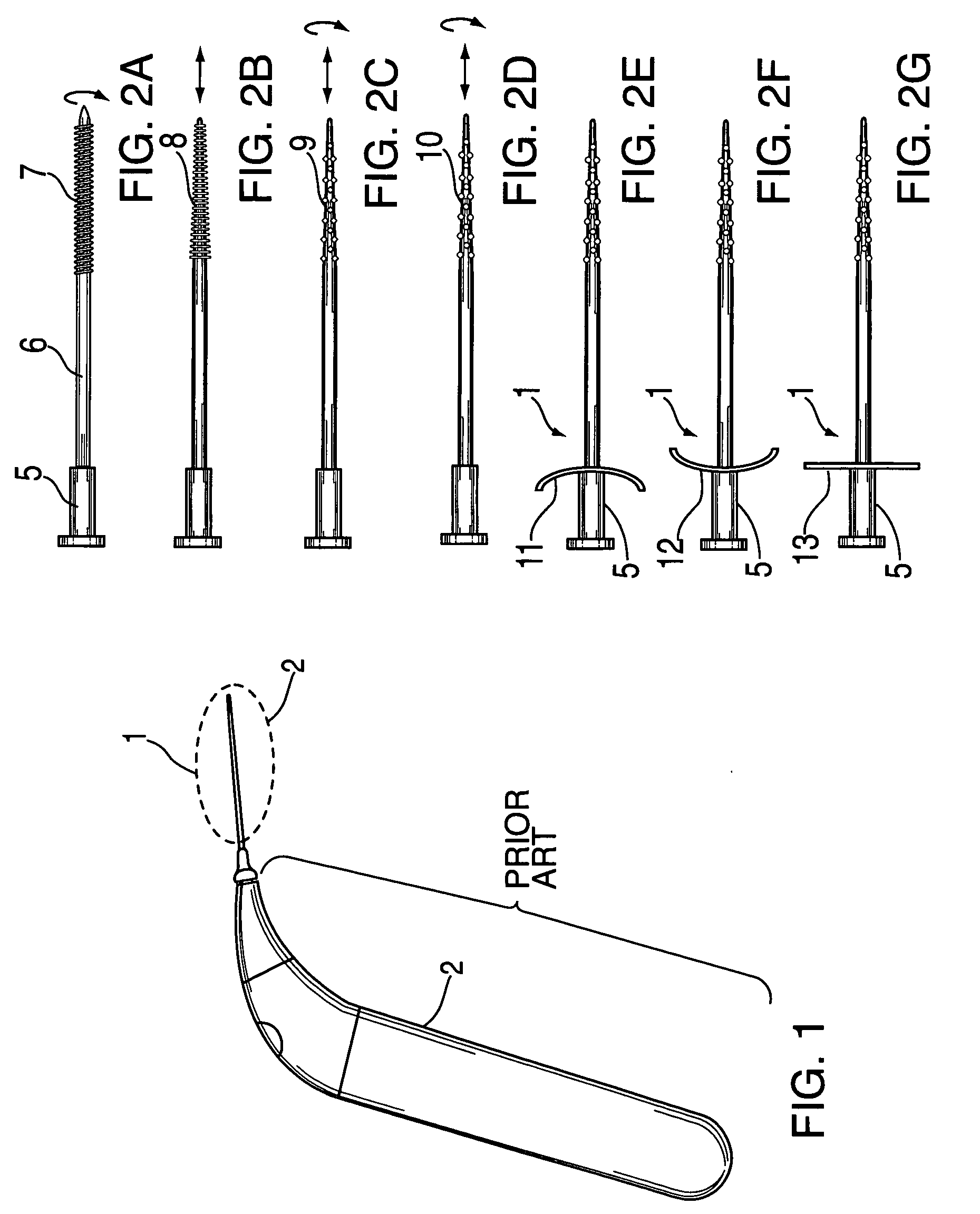 Method and apparatus to remove macro and micro debris from a root canal