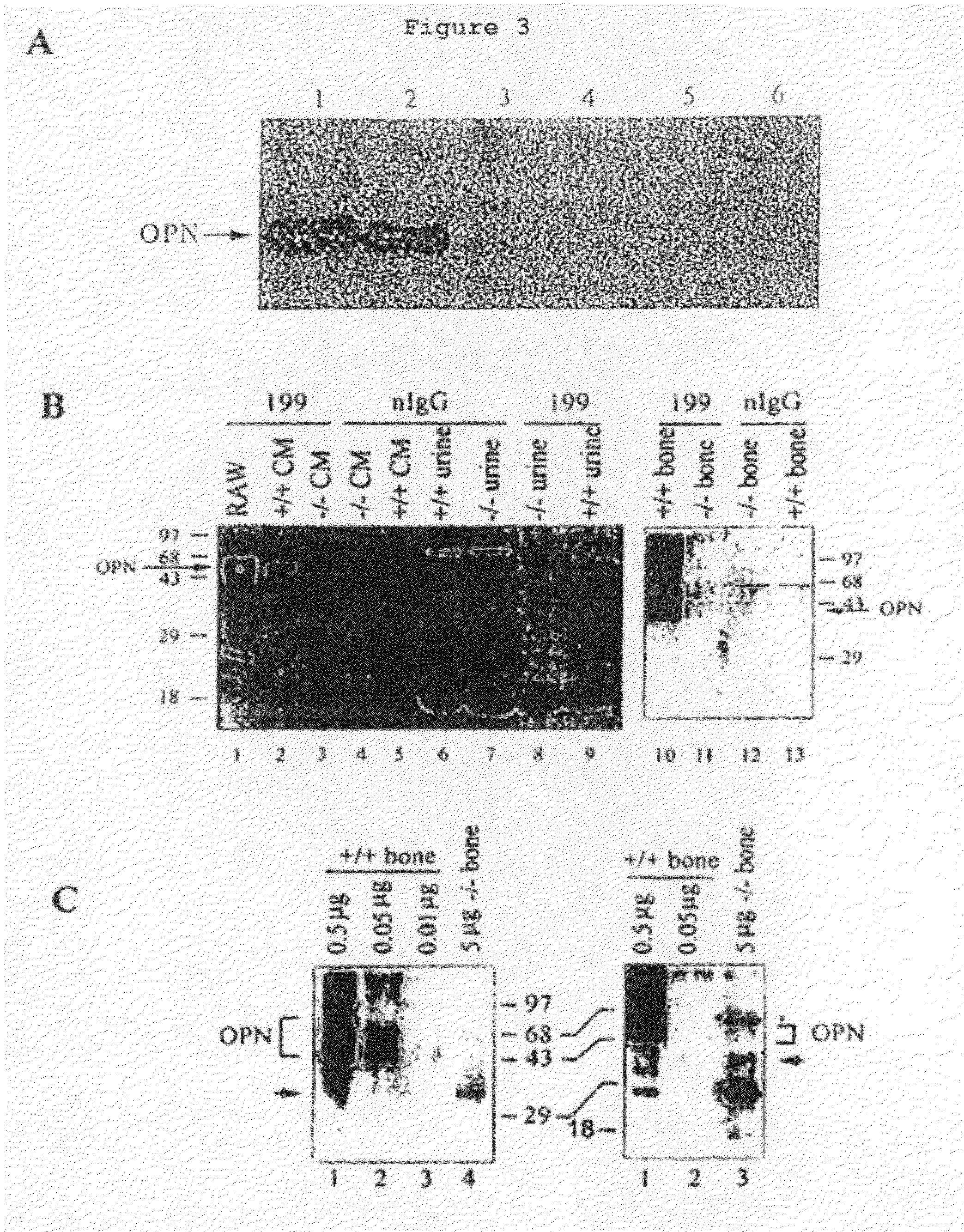 Osteopontin Specific Antibodies and Methods of Use Thereof