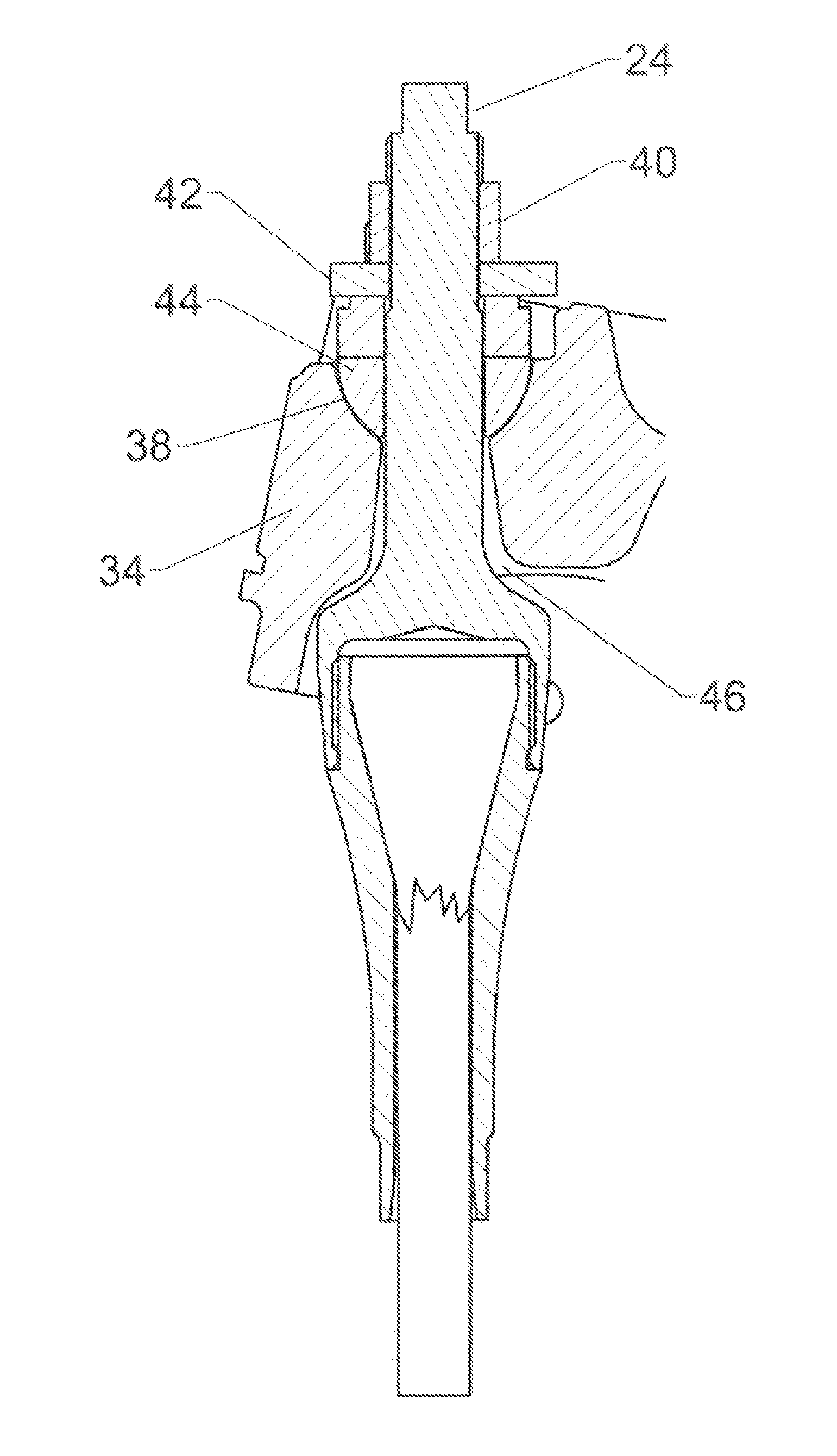 Advanced Methods and Designs for Balancing a Stranded Termination Assembly