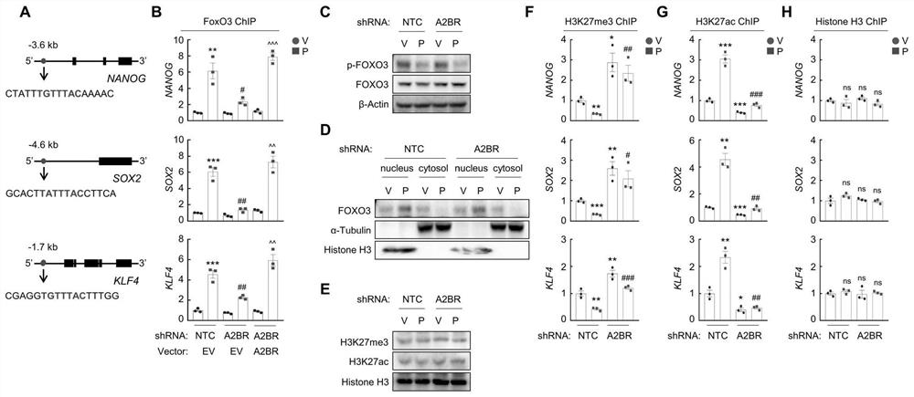 Application of targeted A2BR combined chemotherapy in treatment of triple negative breast cancer