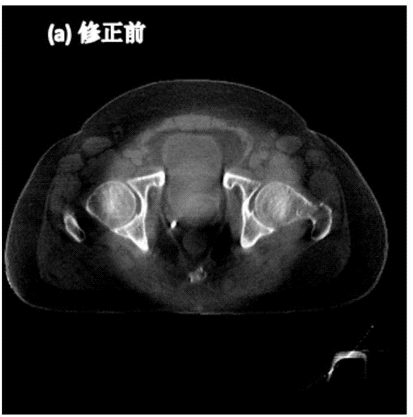 Quick scattering correction method for cone beam CT (Computed Tomography) image domain