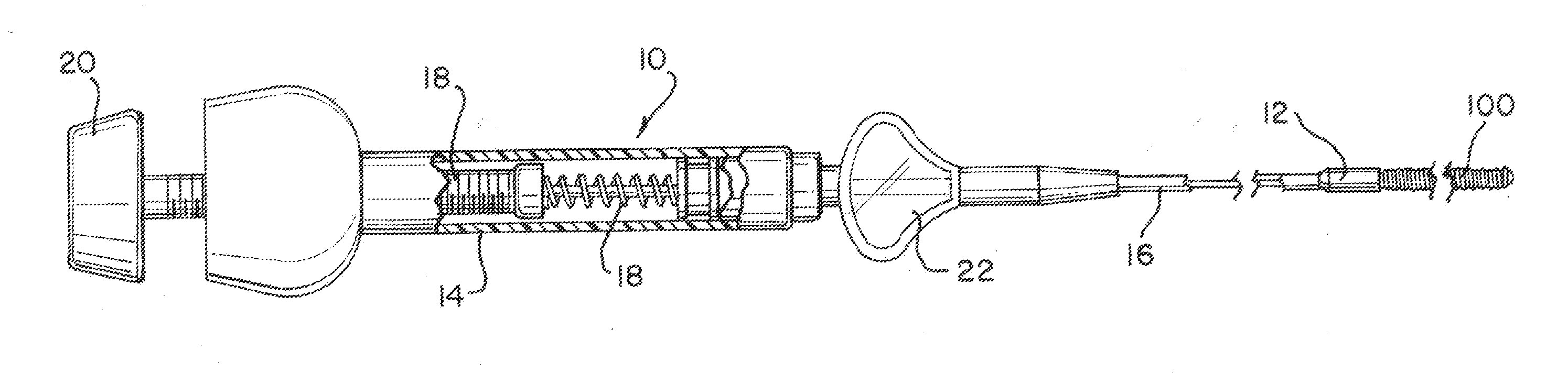 Occlusive device with porous structure and stretch resistant member
