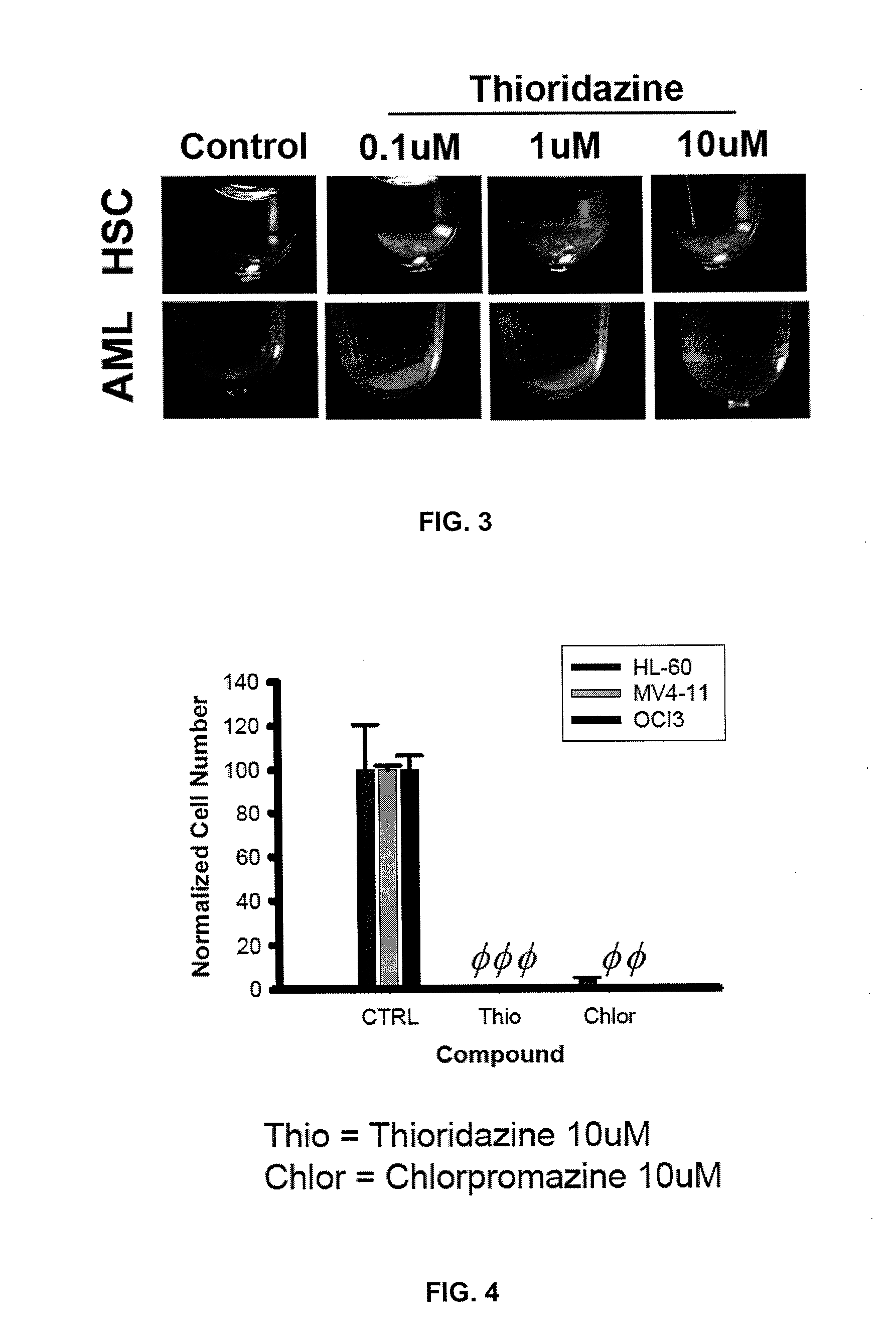 Treatment of Cancer WIth Dopamine Receptor Antagonists