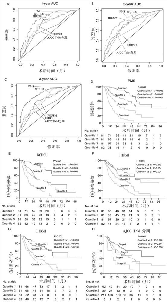 Prognosis detection biomarker and detection kit for intrahepatic cholangiocarcinoma patient