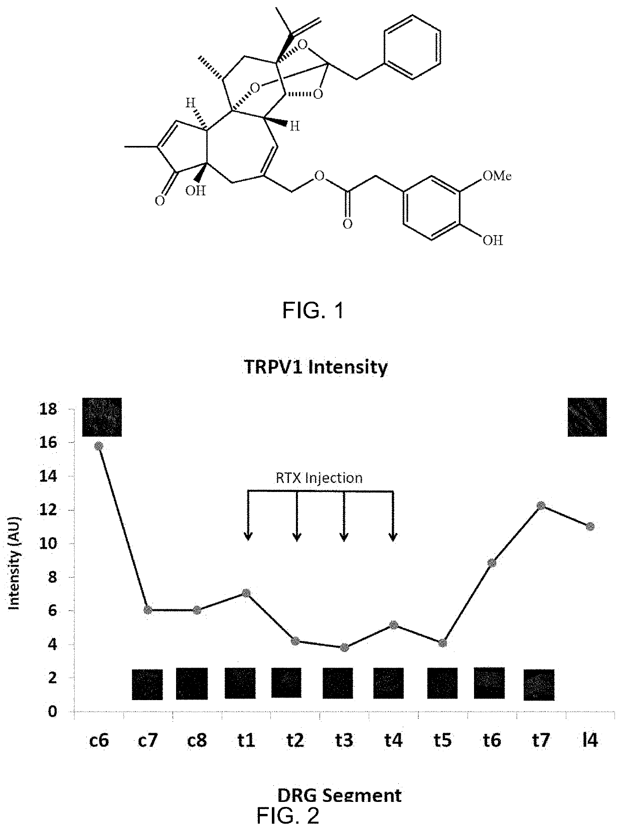 Methods for Administration and Methods for Treating Cardiovascular Diseases with Resiniferatoxin