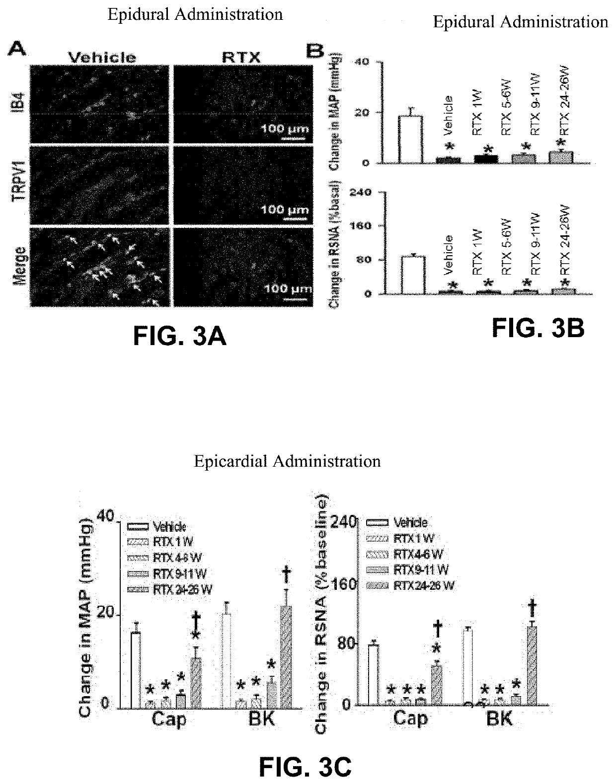 Methods for Administration and Methods for Treating Cardiovascular Diseases with Resiniferatoxin