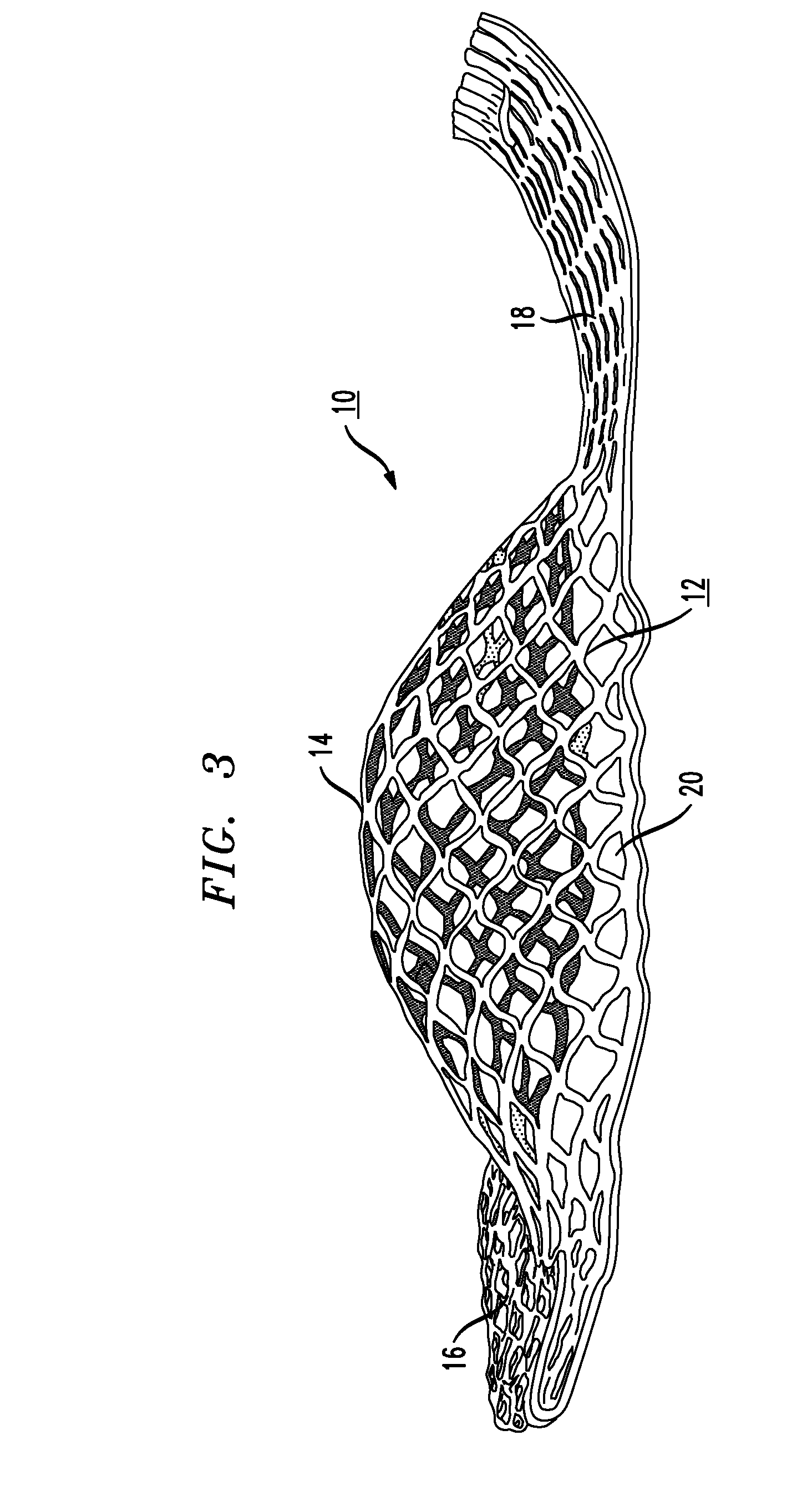 Lacrosse Head Including Pre-Fabricated Pocket Area