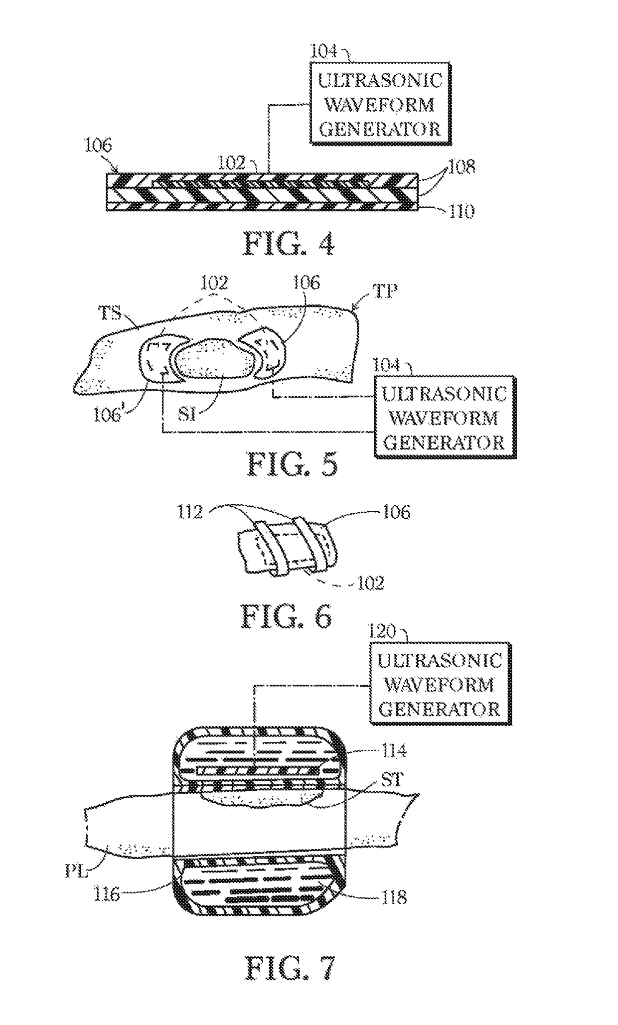 Method for reducing biofilm formation