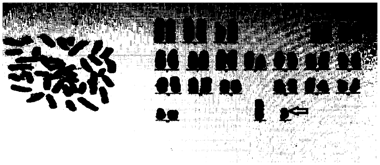 A kind of establishment method of C5AR gene knockout mouse cgvhd model