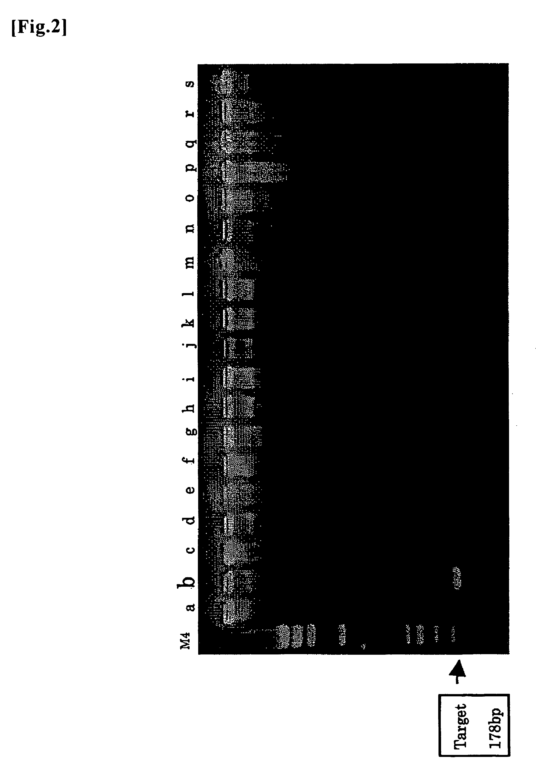 Probe and primer for tubercle bacillus detection, and method of detecting human tubercle bacillus therewith