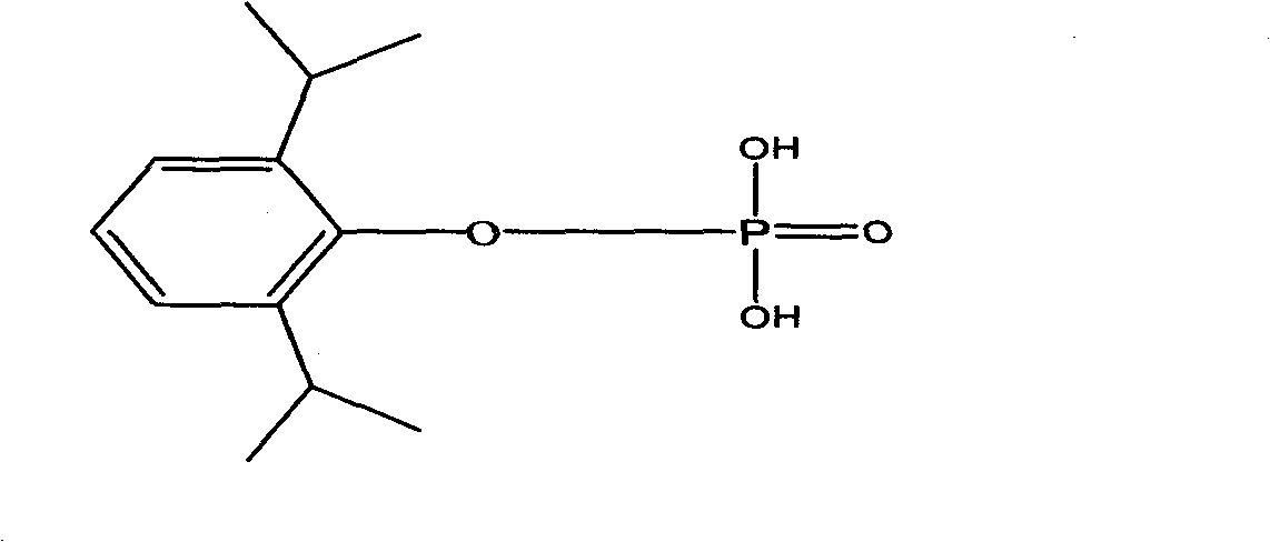 Propofol phosphate for injection and preparation method and application thereof