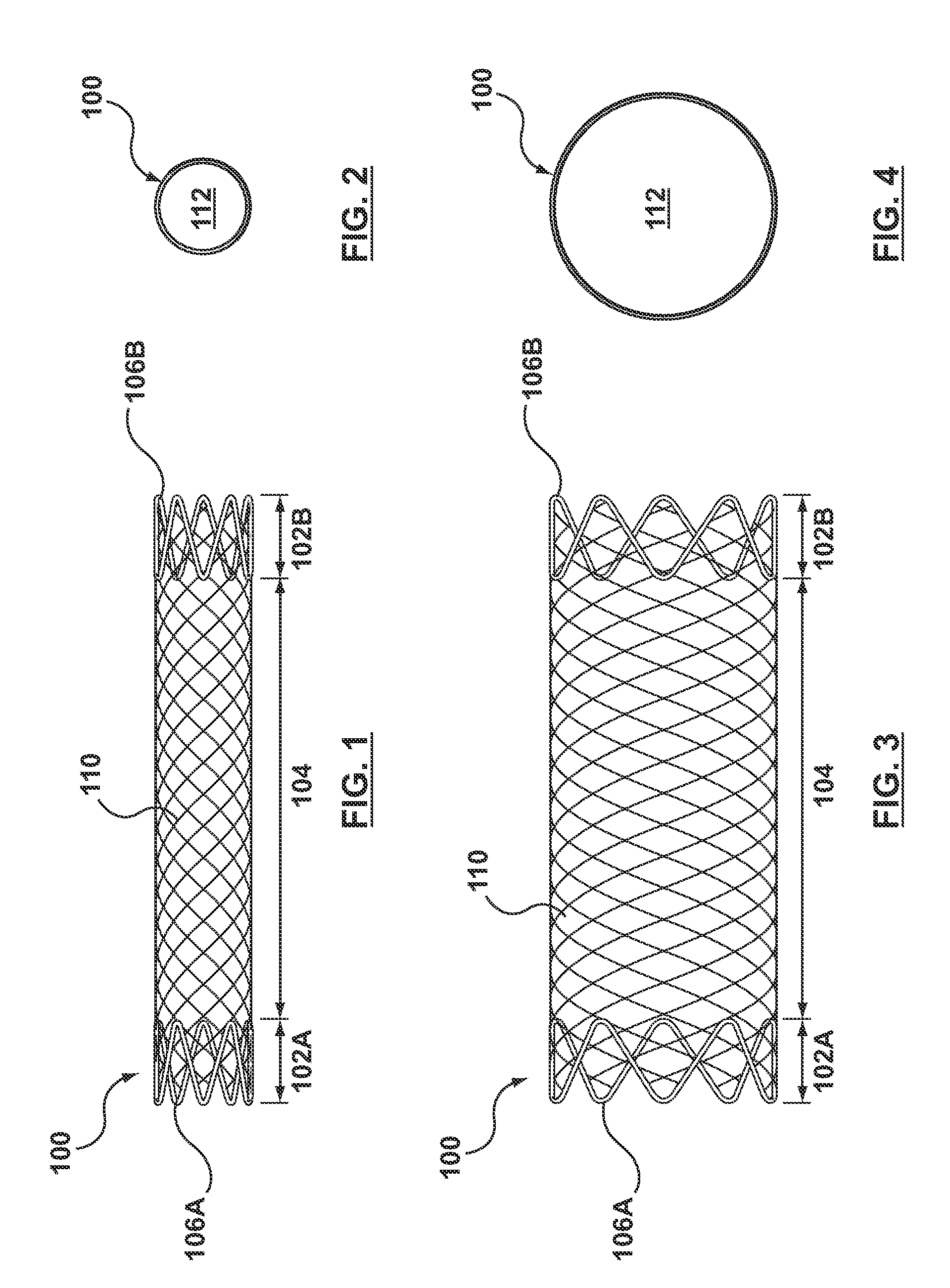 Biodegradable Stent Having Non-Biodegradable End Portions and Mechanisms for Increased Stent Hoop Strength