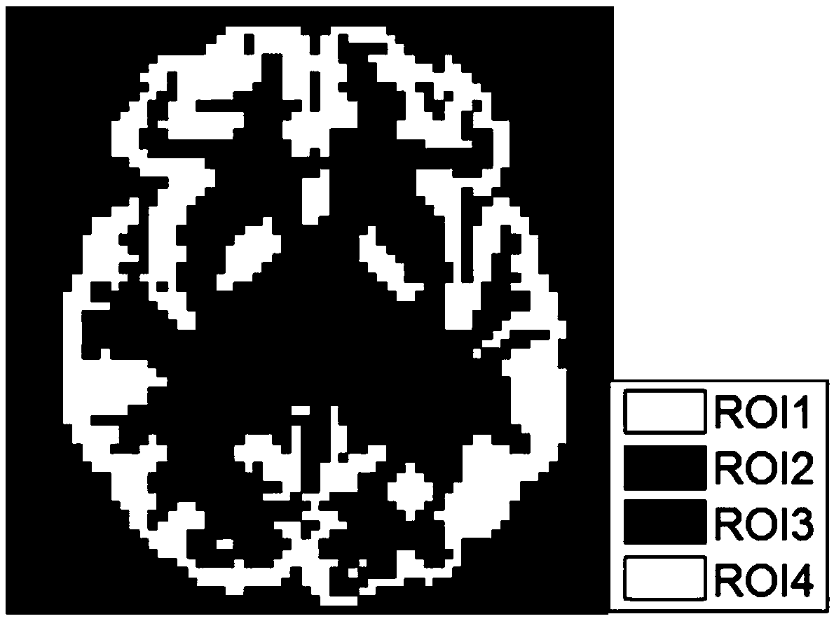 Dynamic PET image tracer kinetic macro parameter estimation method based on stacked autoencoder