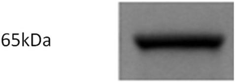 Nanometer antibody resisting to rabies virus G protein and application of nanometer antibody