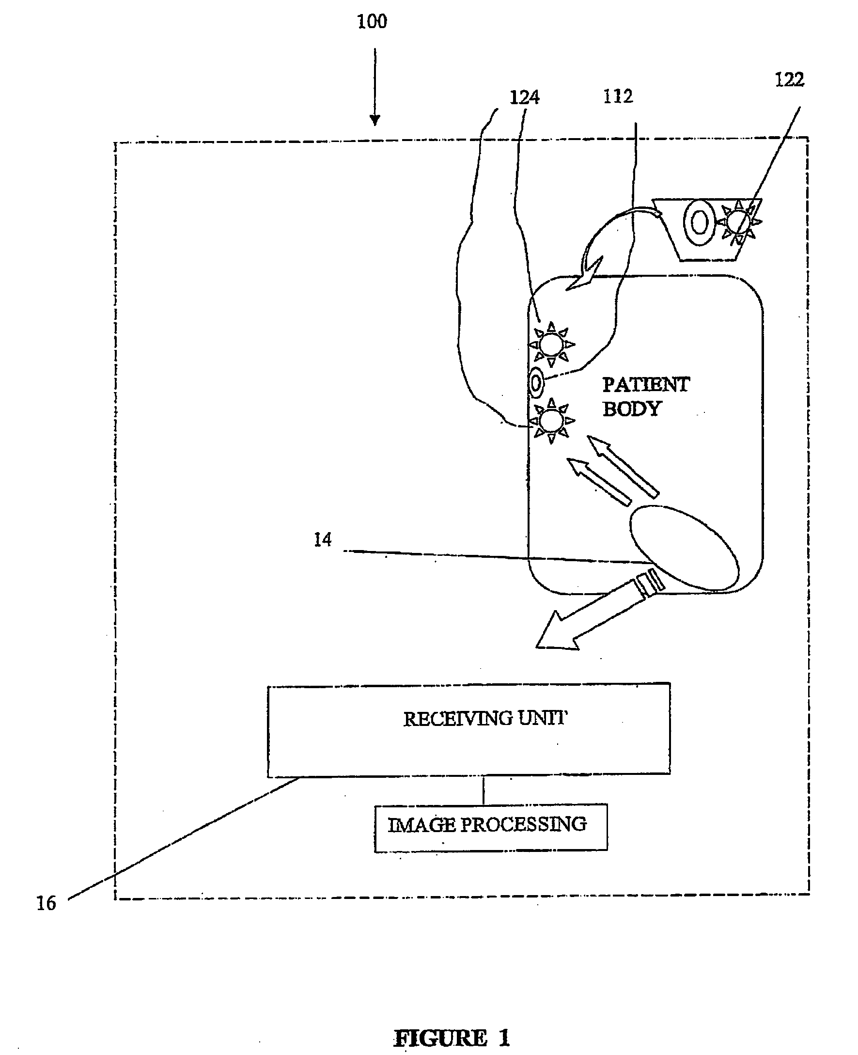 Methods, device and system for in vivo diagnosis