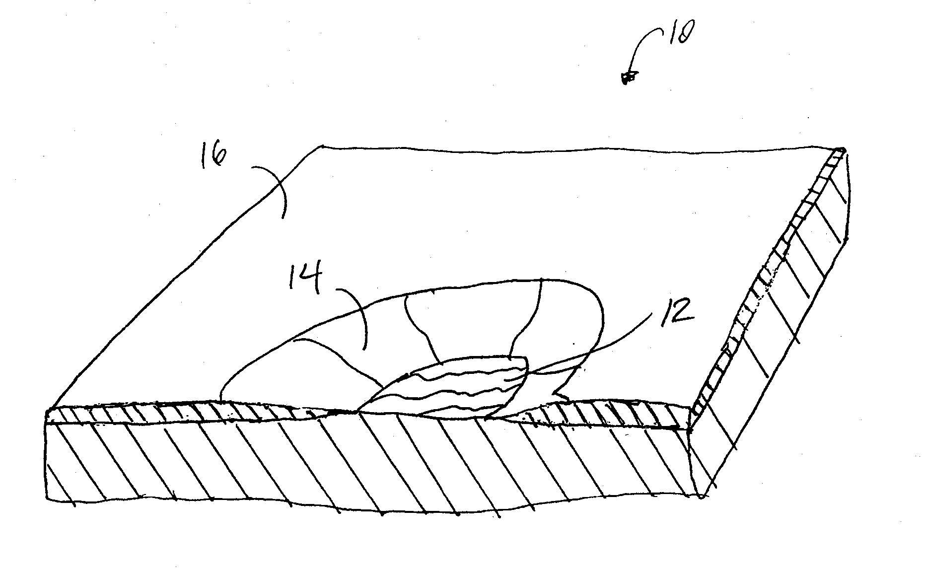 Method For Treating Wound, Dressing For Use Therewith Apparatus And System for Fabricating Dressing