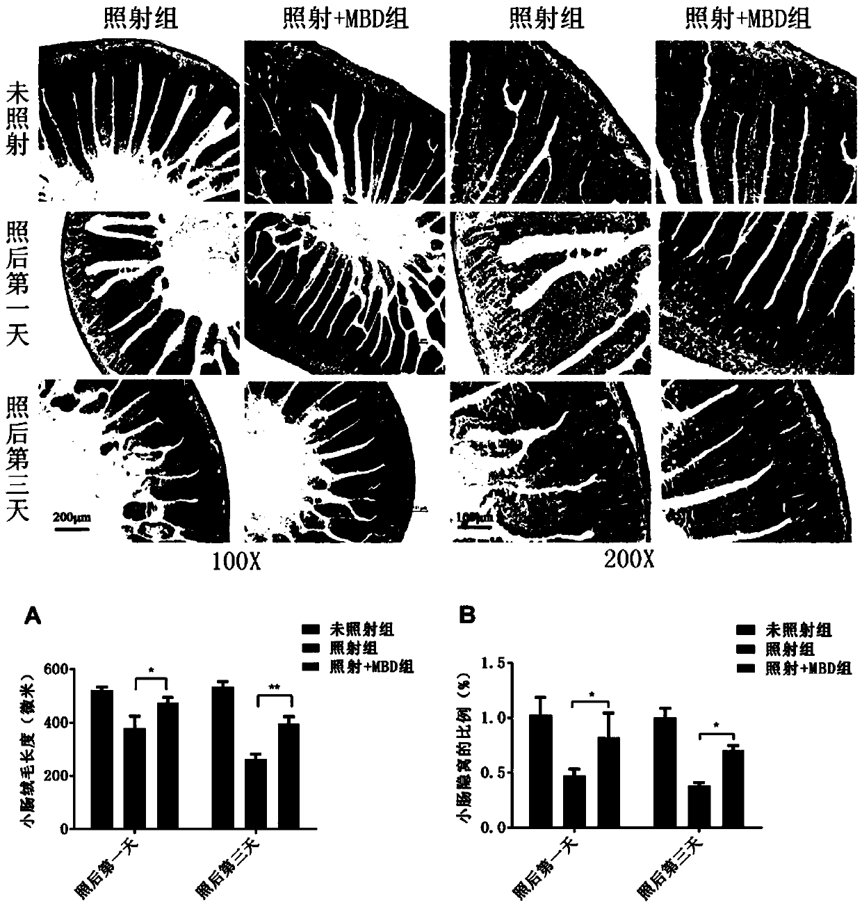 Application of Murabutide to preparation of medicine for preventing and treating bone marrow, small intestine and spleen injury caused by ionization radiation