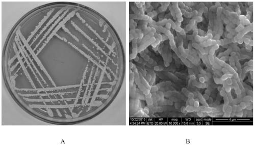 An endophytic actinomycete osilf-2 strain against rice blast fungus in vitro