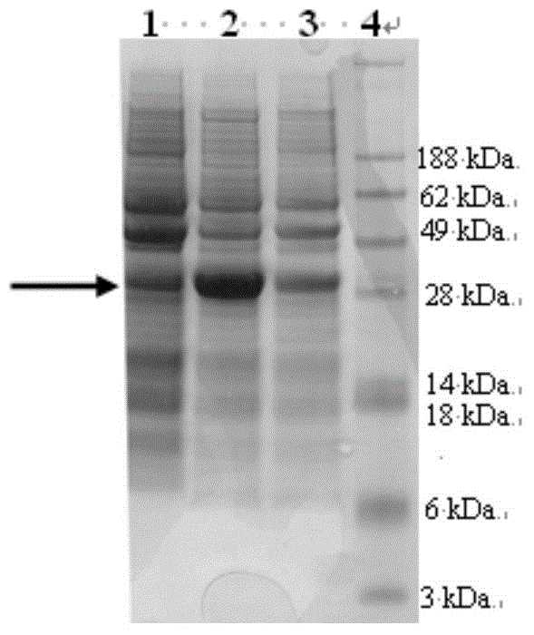 Anti-HIV aedes albopictus protein with platelet aggregation inhibiting function and preparation method of anti-HIV aedes albopictus protein
