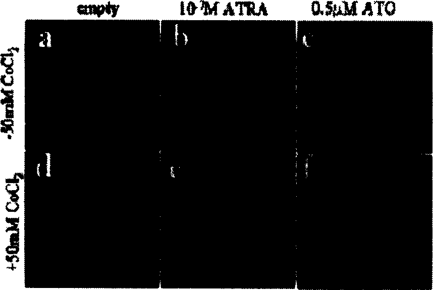 Use of CoCl#-[2] in preparation of drug for treating leukemia