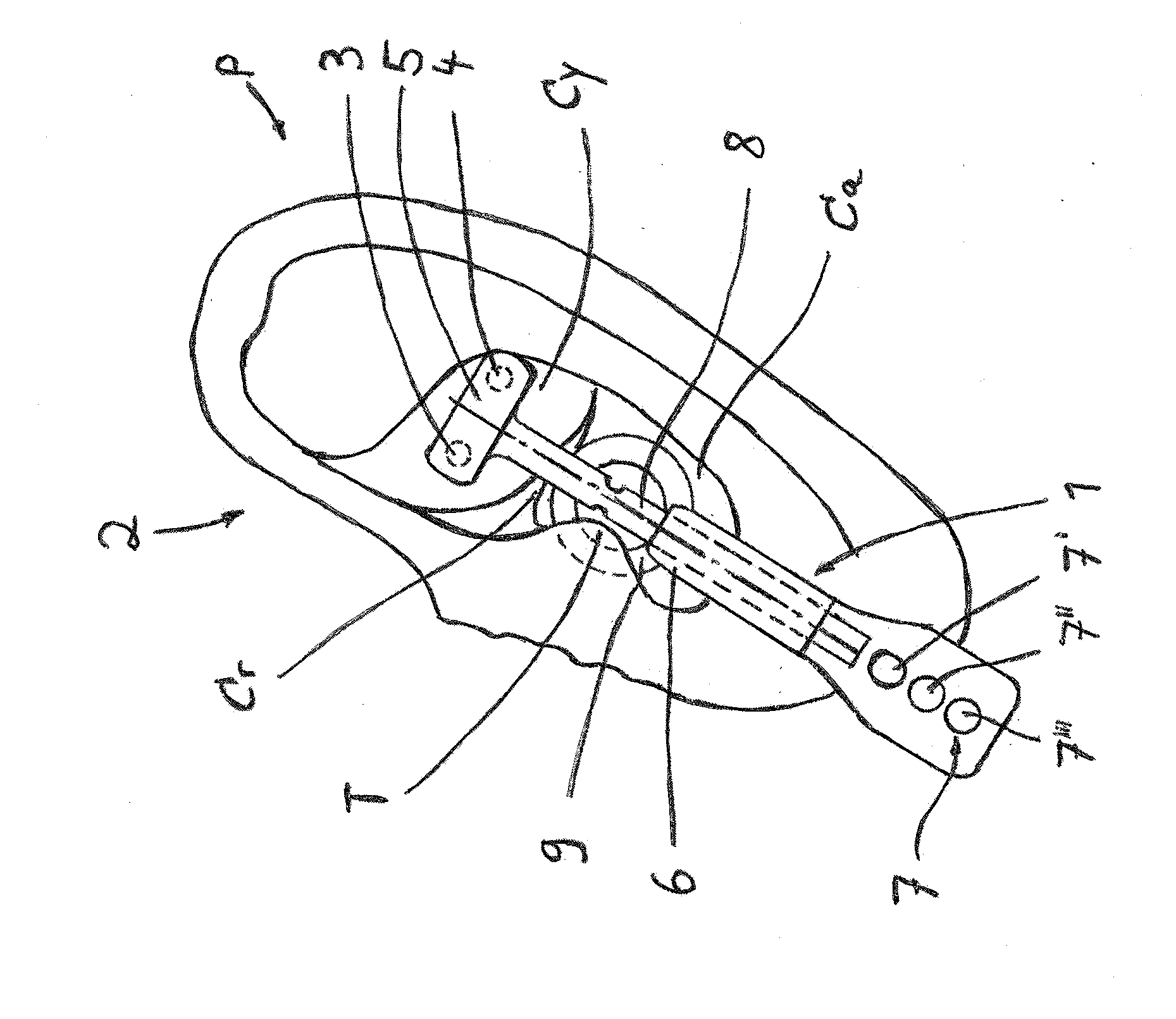 Device for the application of a transcutaneous electrical stimulation stimulus