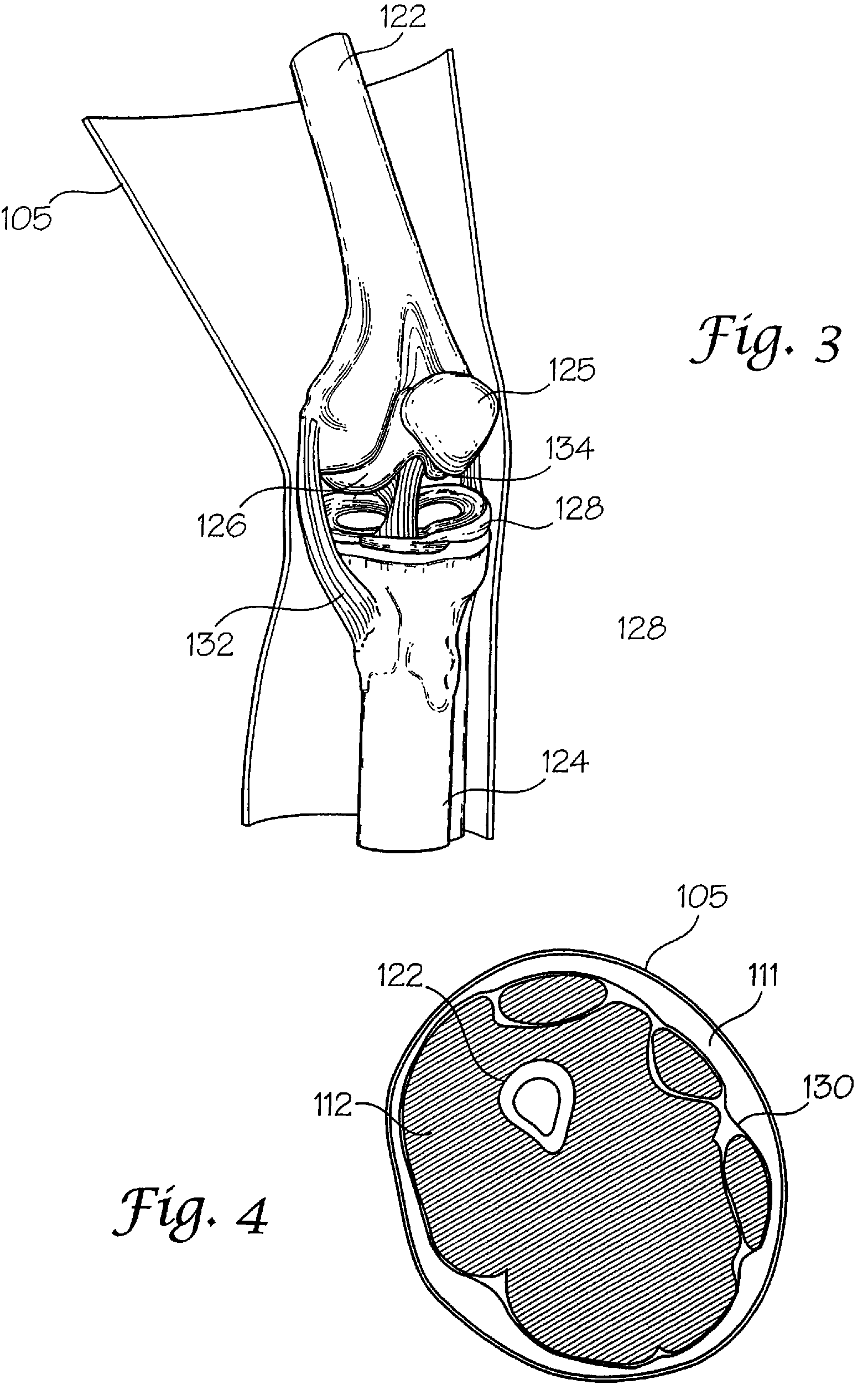 Joint replica models and methods of using same for testing medical devices