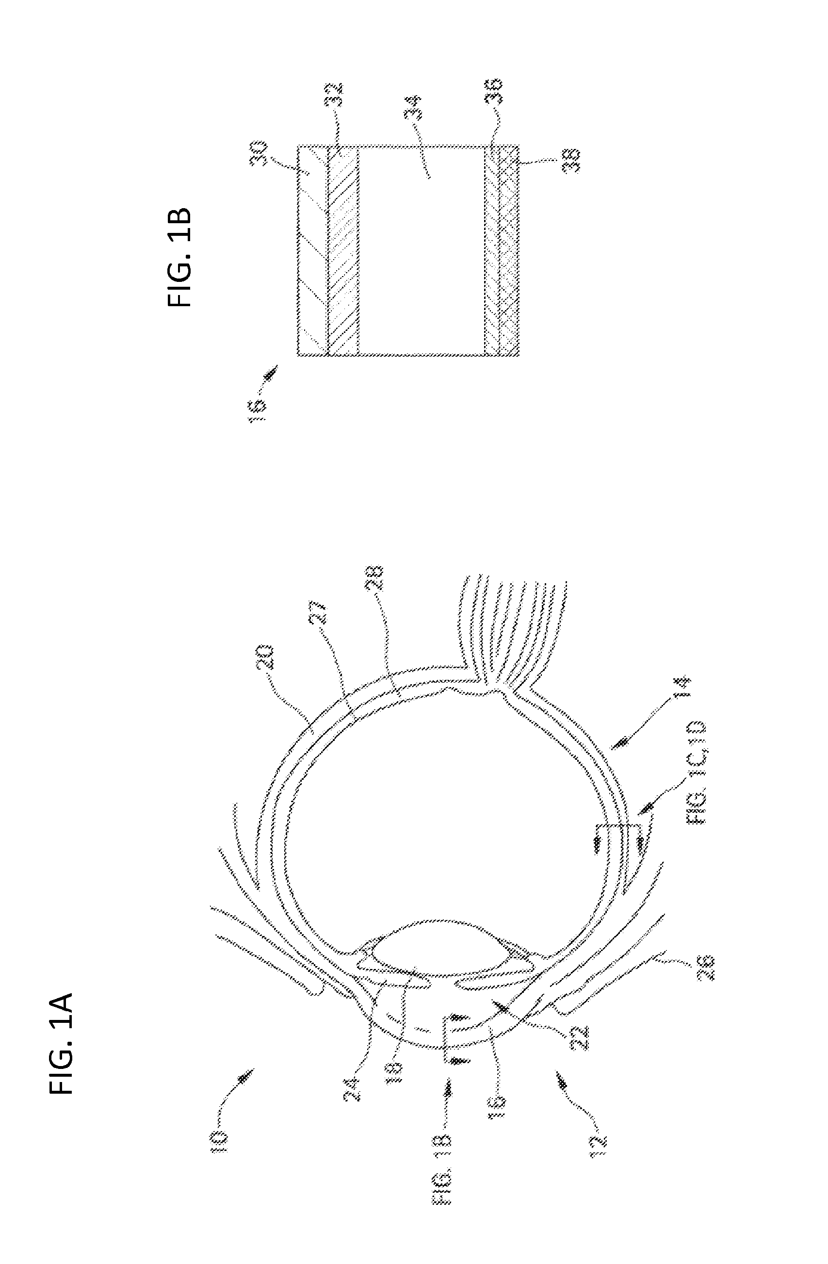 Methods and devices for the treatment of ocular diseases in human subjects