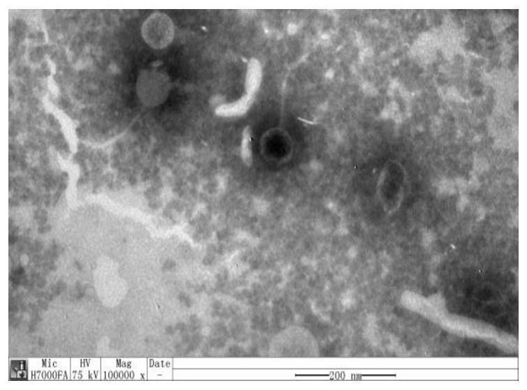 Salmonella typhimurium bacteriophage T156 and application thereof