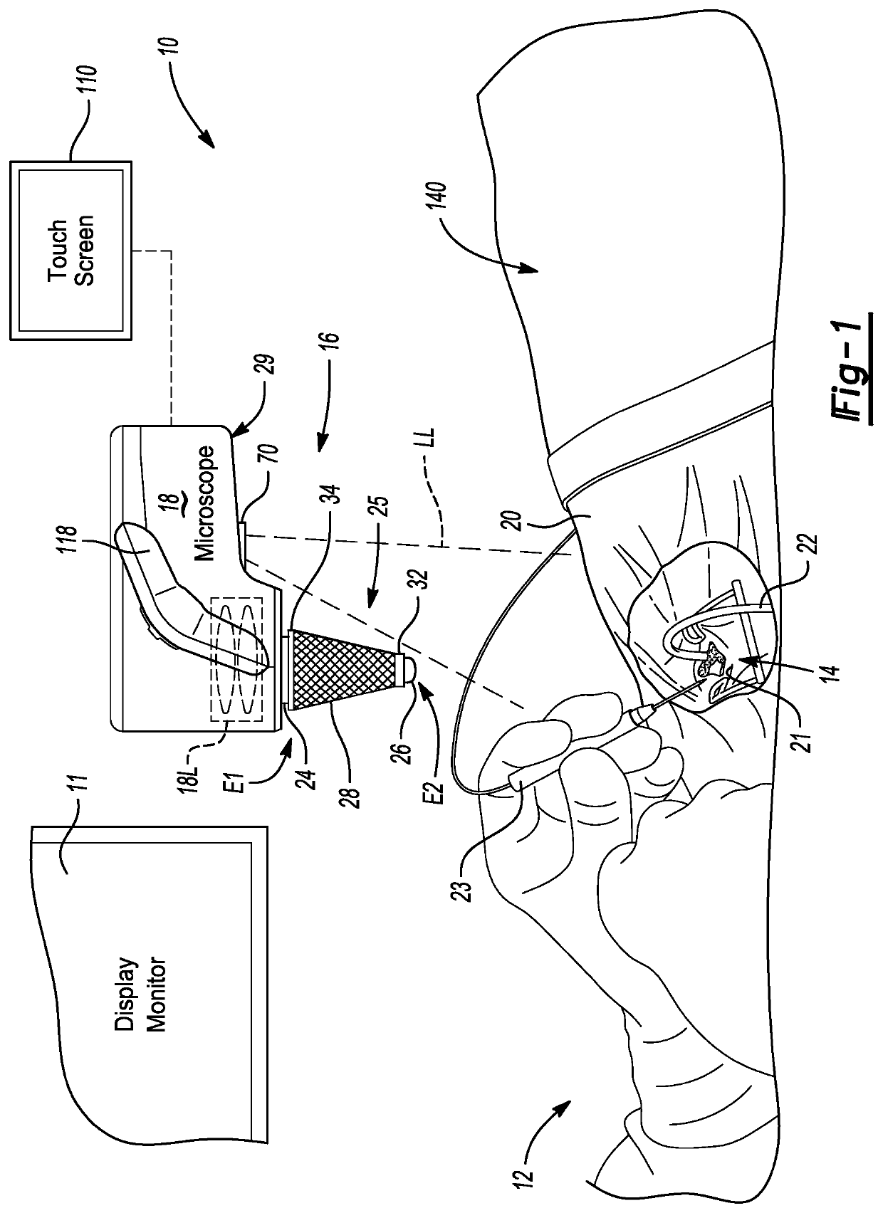 Non-contact wide angle retina viewing system