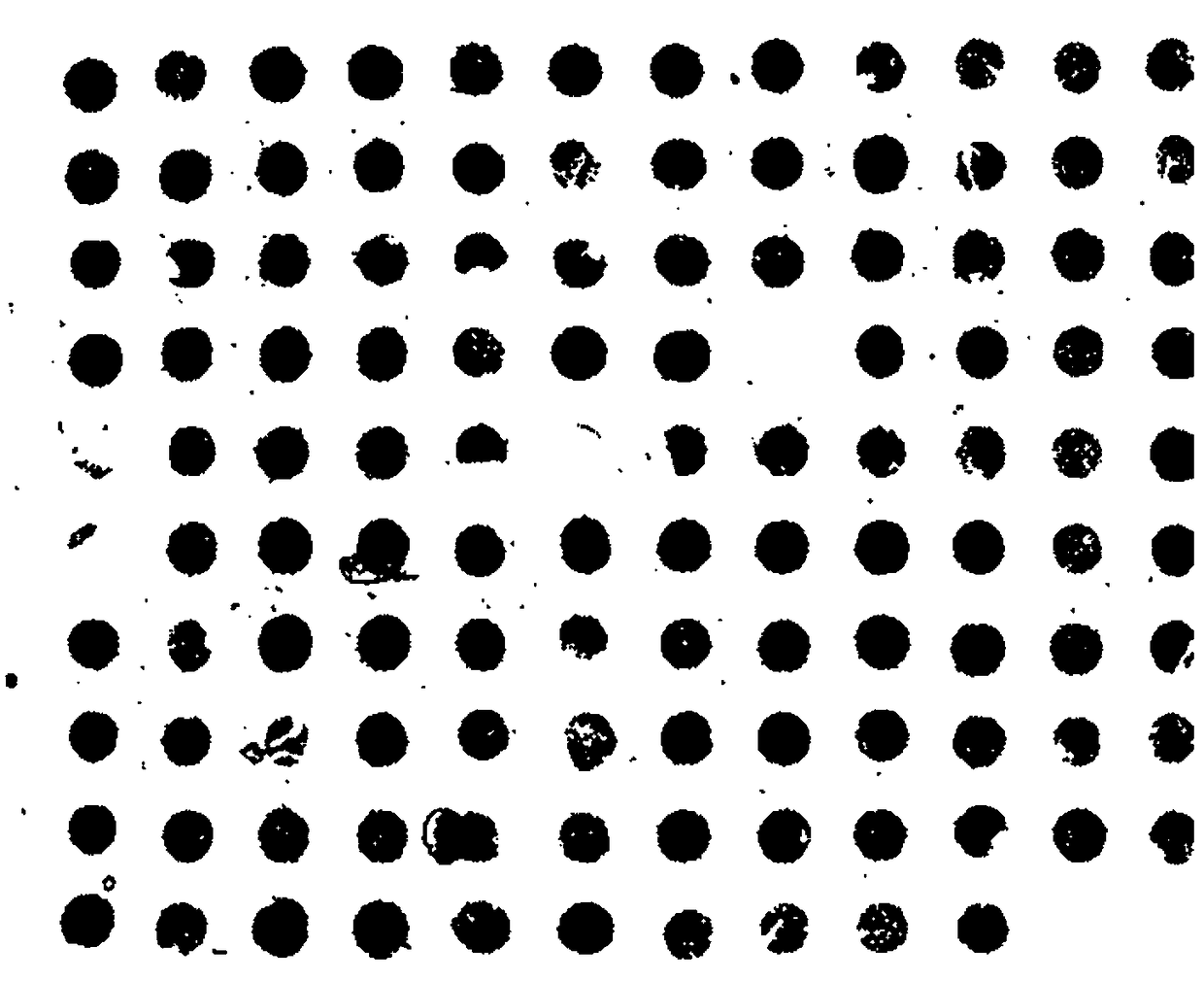 An automatic segmentation method for microarray images of tumor tissue