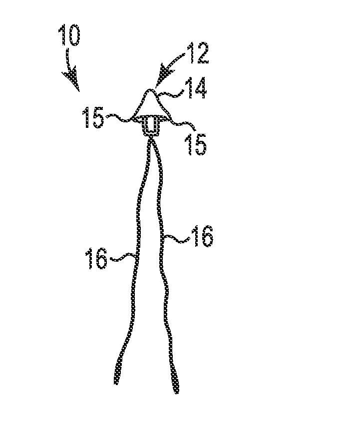 Transperitoneal prolapse repair system and method