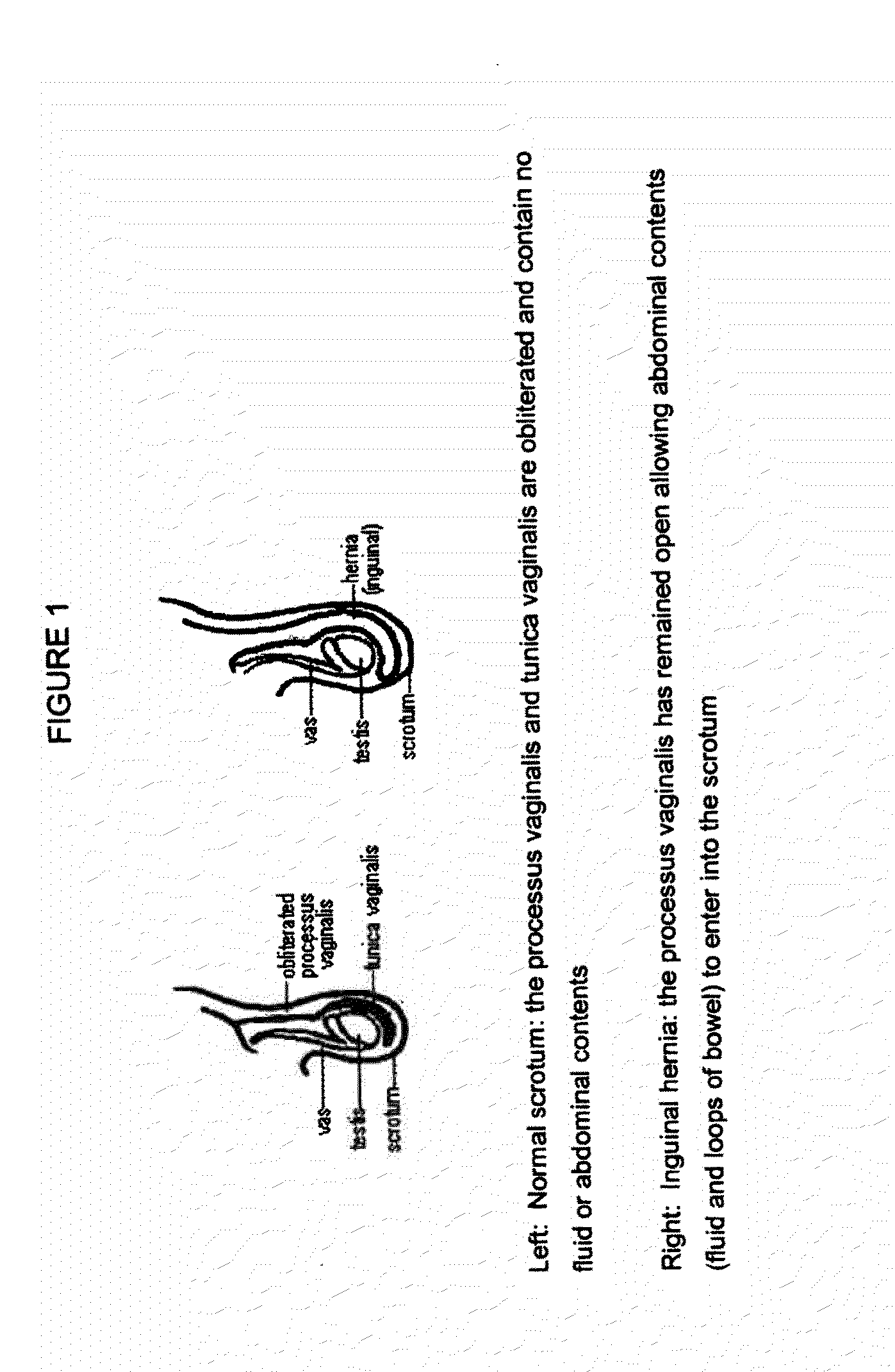 Surgical adhesive and uses therefore