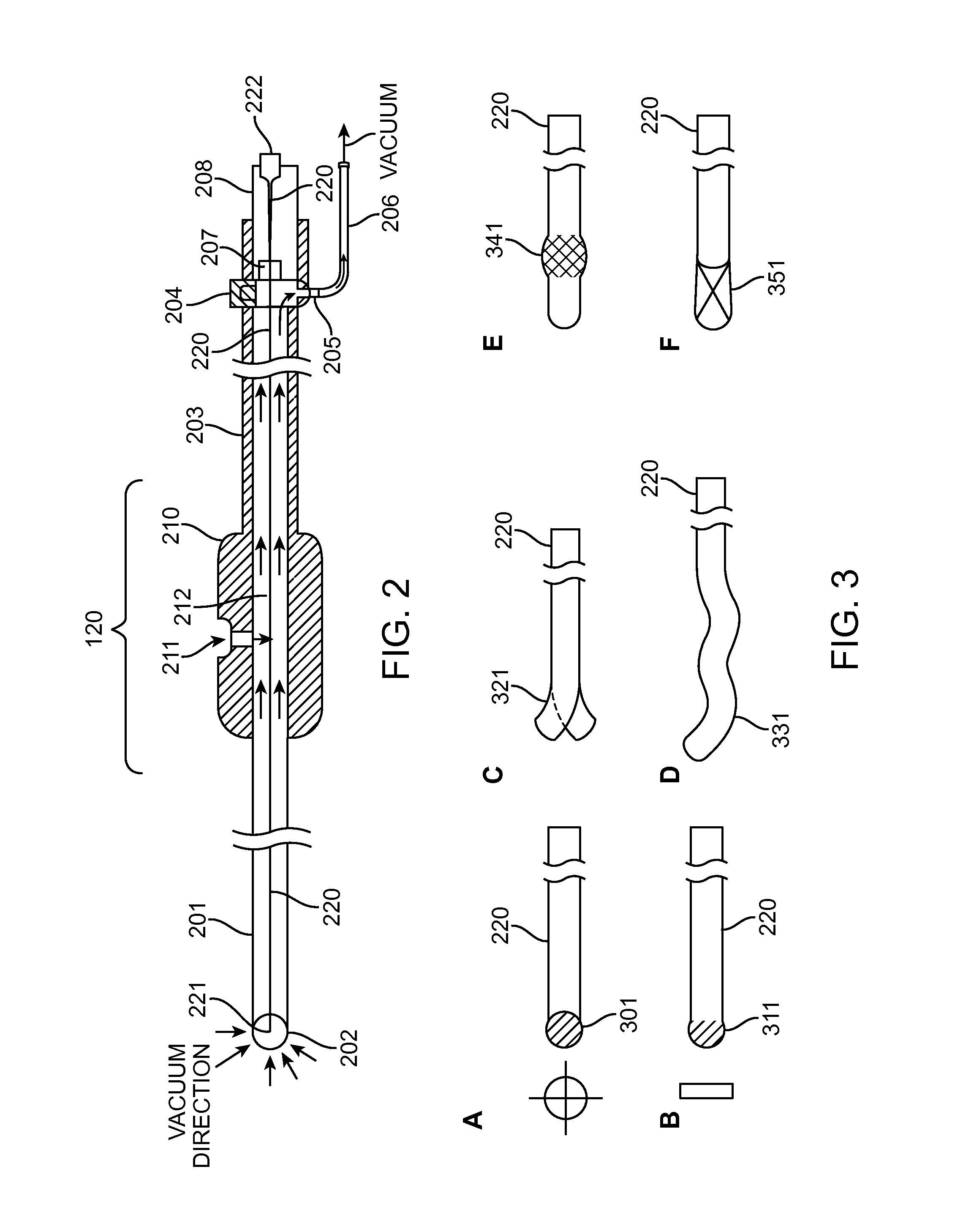 Methods and Devices for Removing Obstructing Material From the Human Body