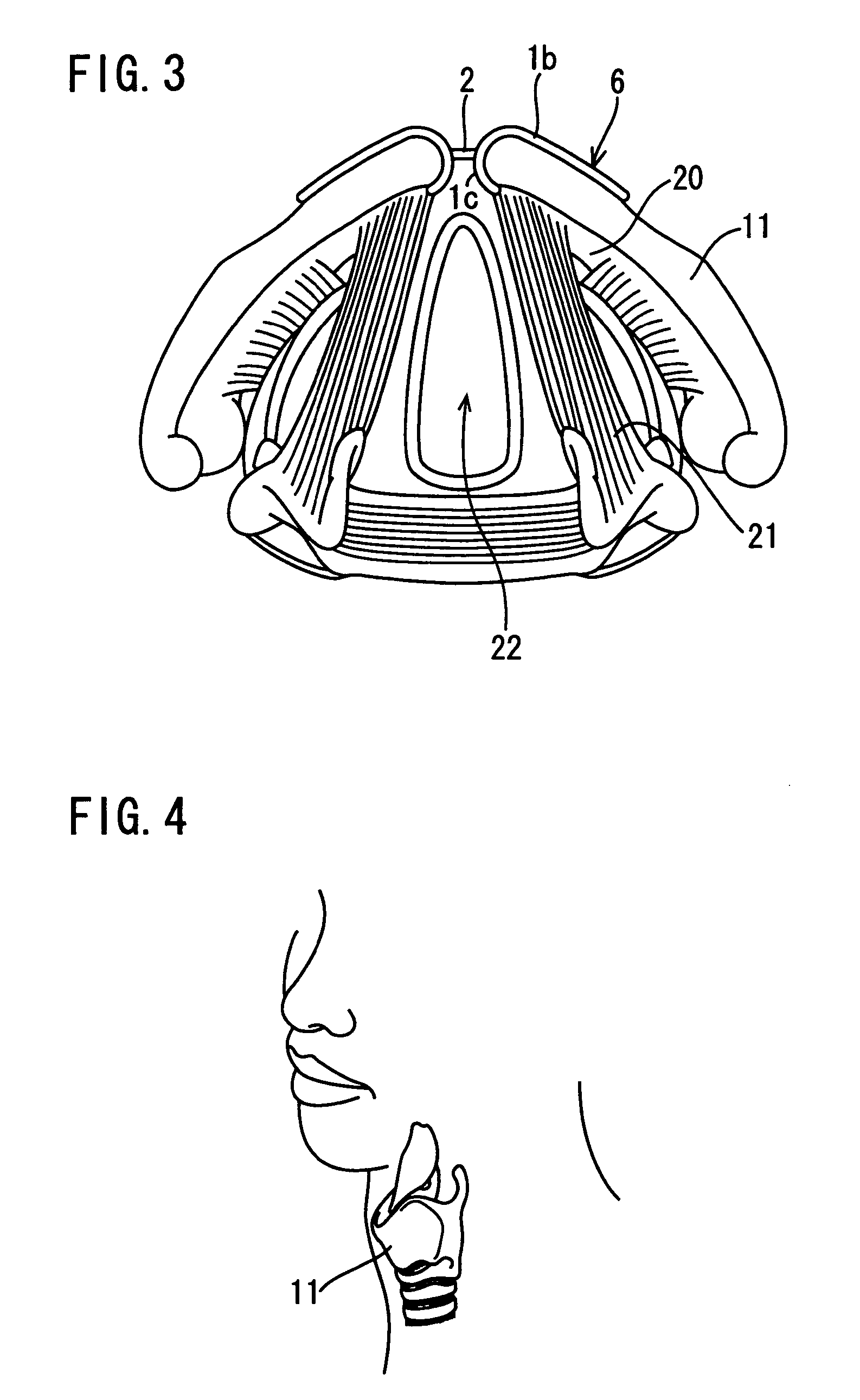 Device for treating dysphonia and method of treating with use of the same