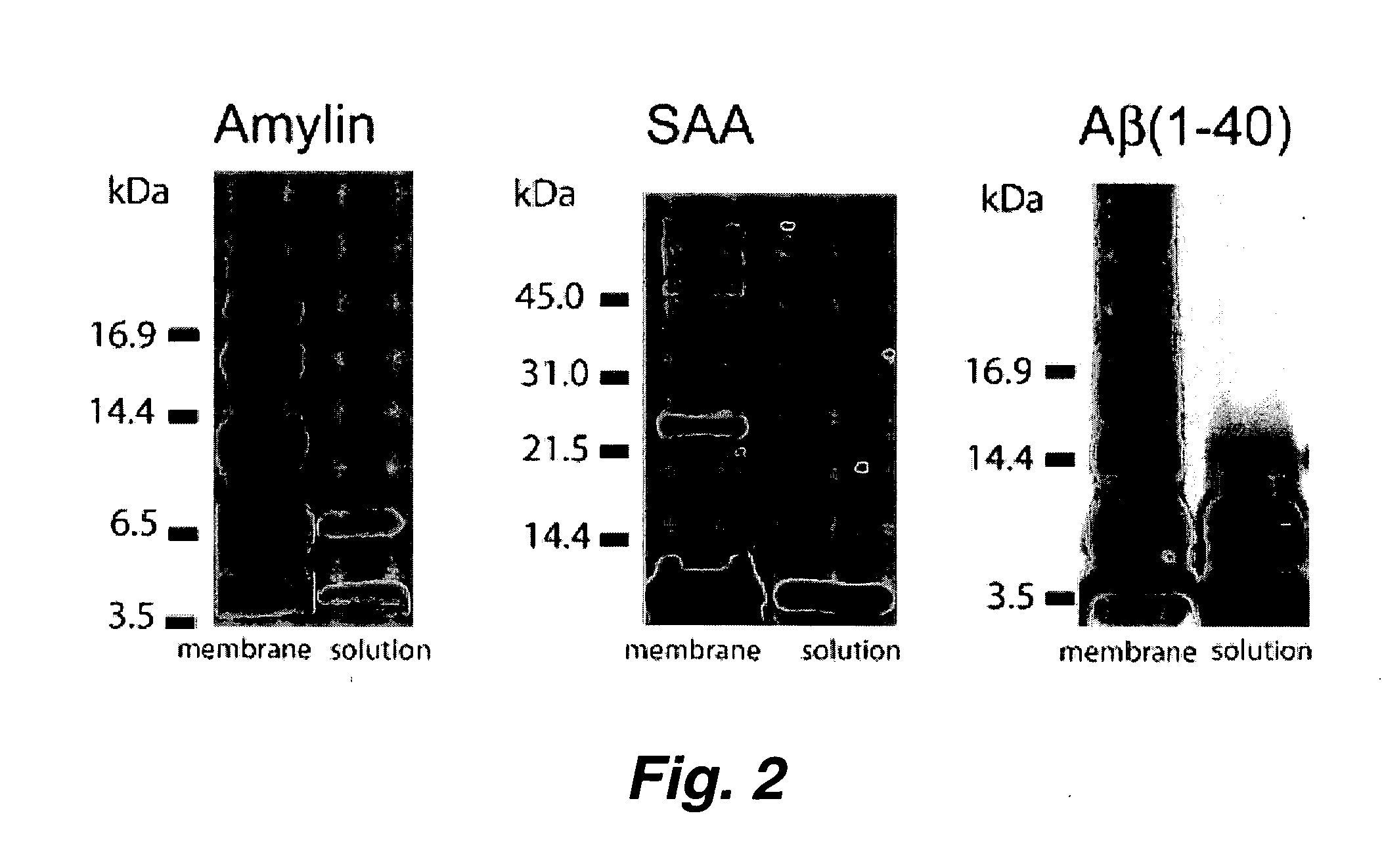 Amyloid beta protein channel structure and uses thereof in identifying potential drug molecules for neurodegenerative diseases