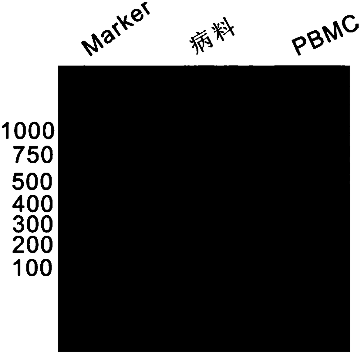 In vitro proliferation and culture method for duck circovirus