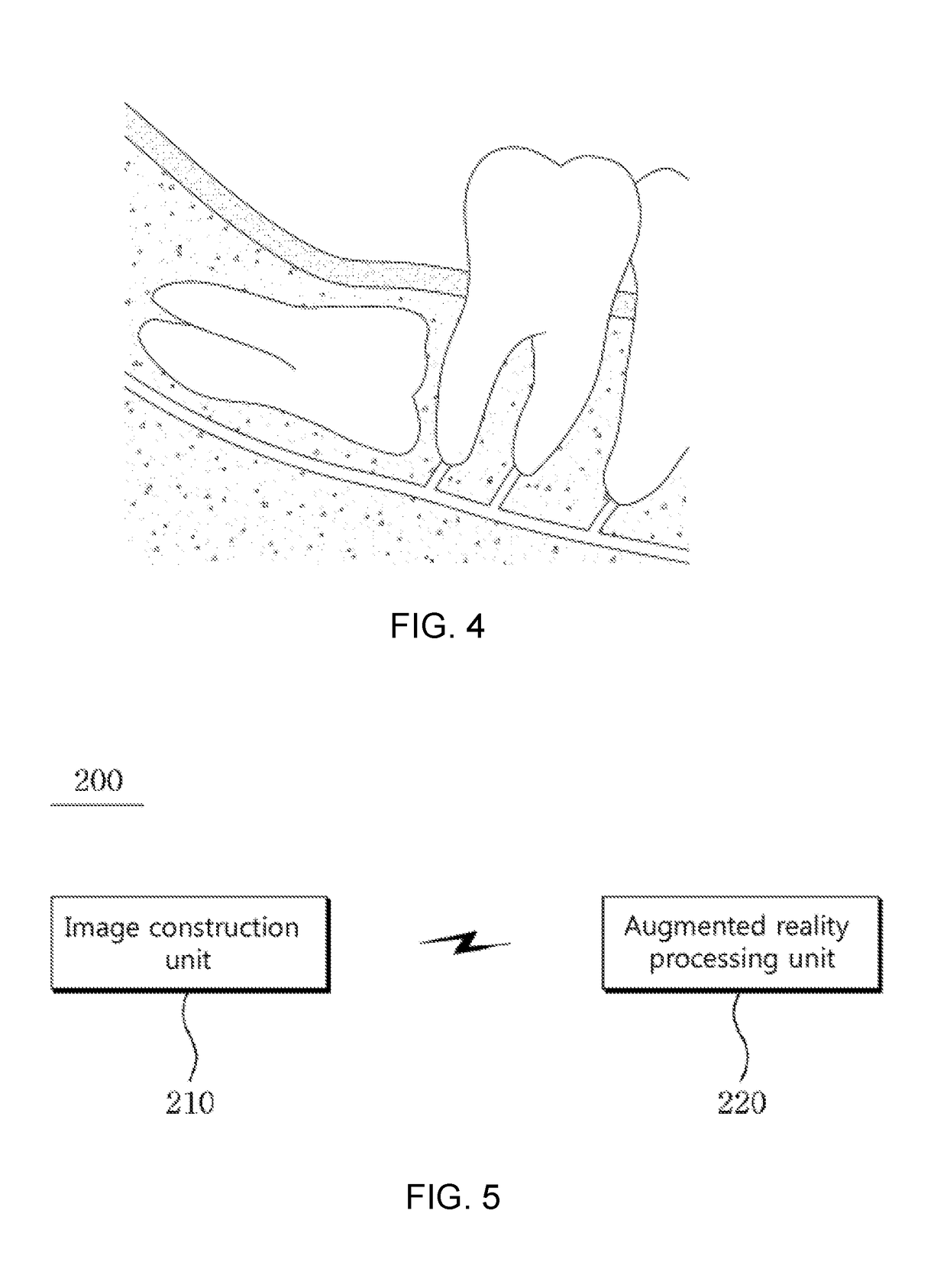 Augmented Reality System and Method for Implementing Augmented Reality for Dental Surgery