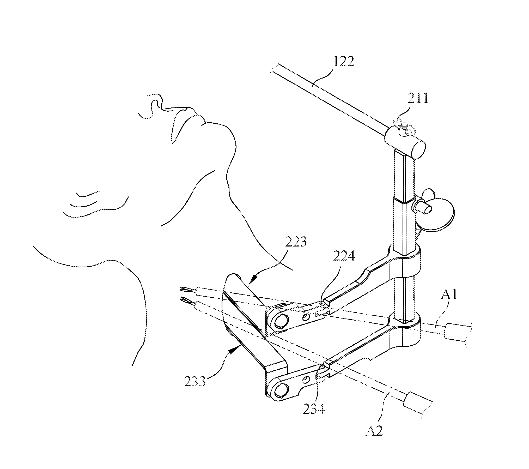 Device of automatic mechanical wound opener for head and neck surgery